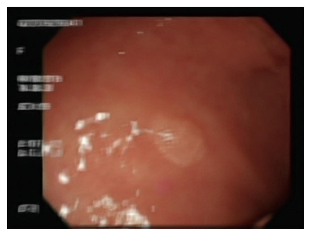 Diagnostics 13 00170 g014