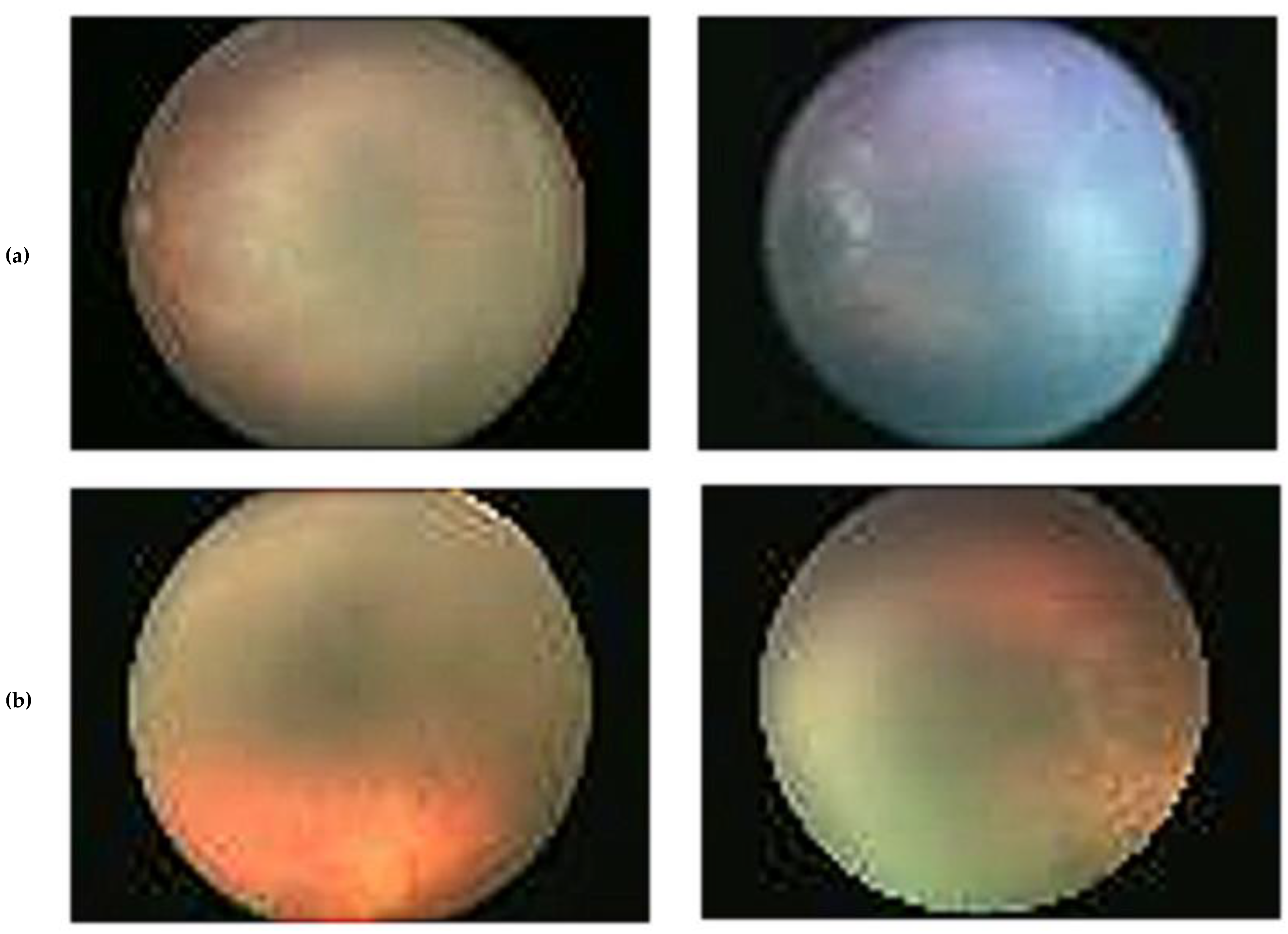 Diagnostics 13 00171 g001