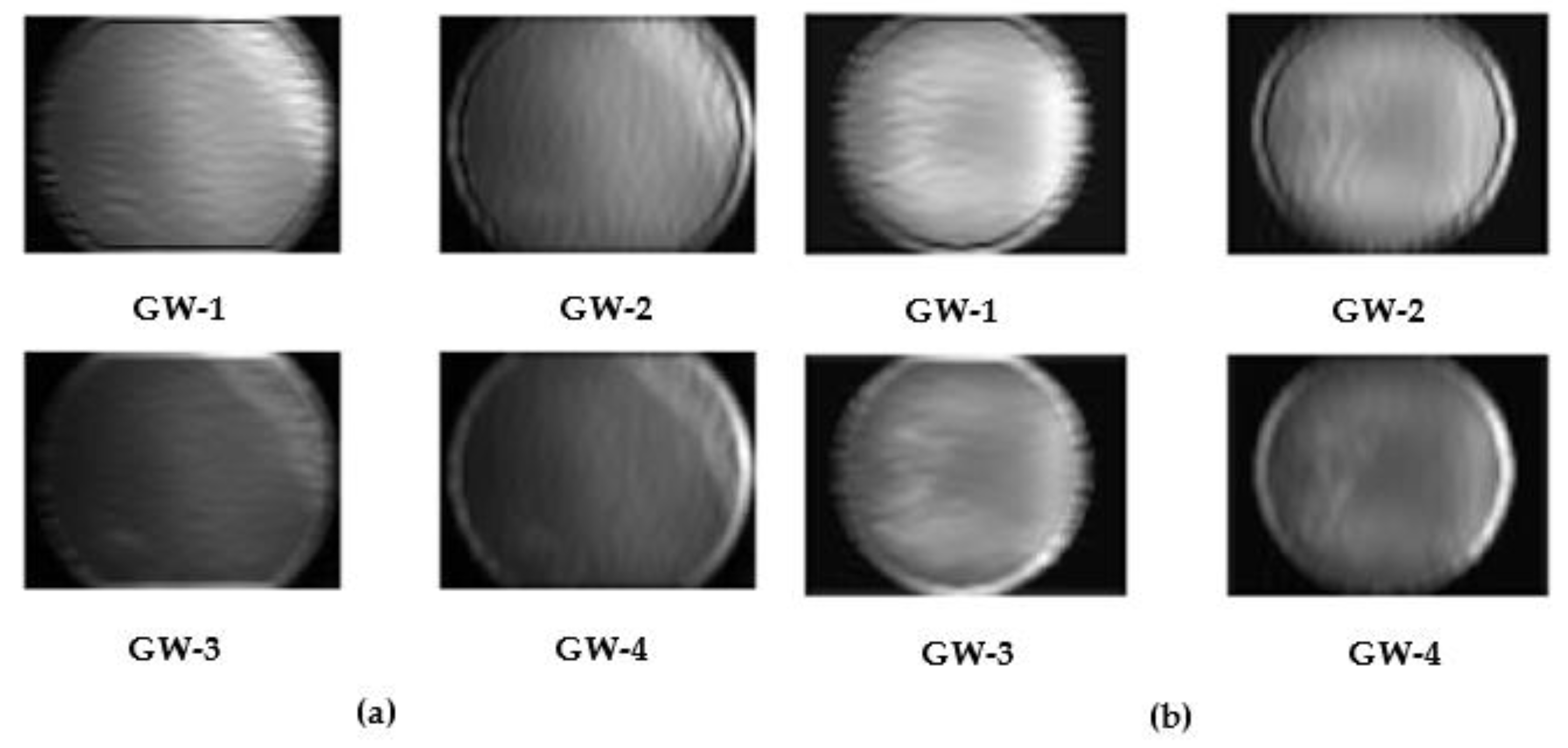 Diagnostics 13 00171 g003