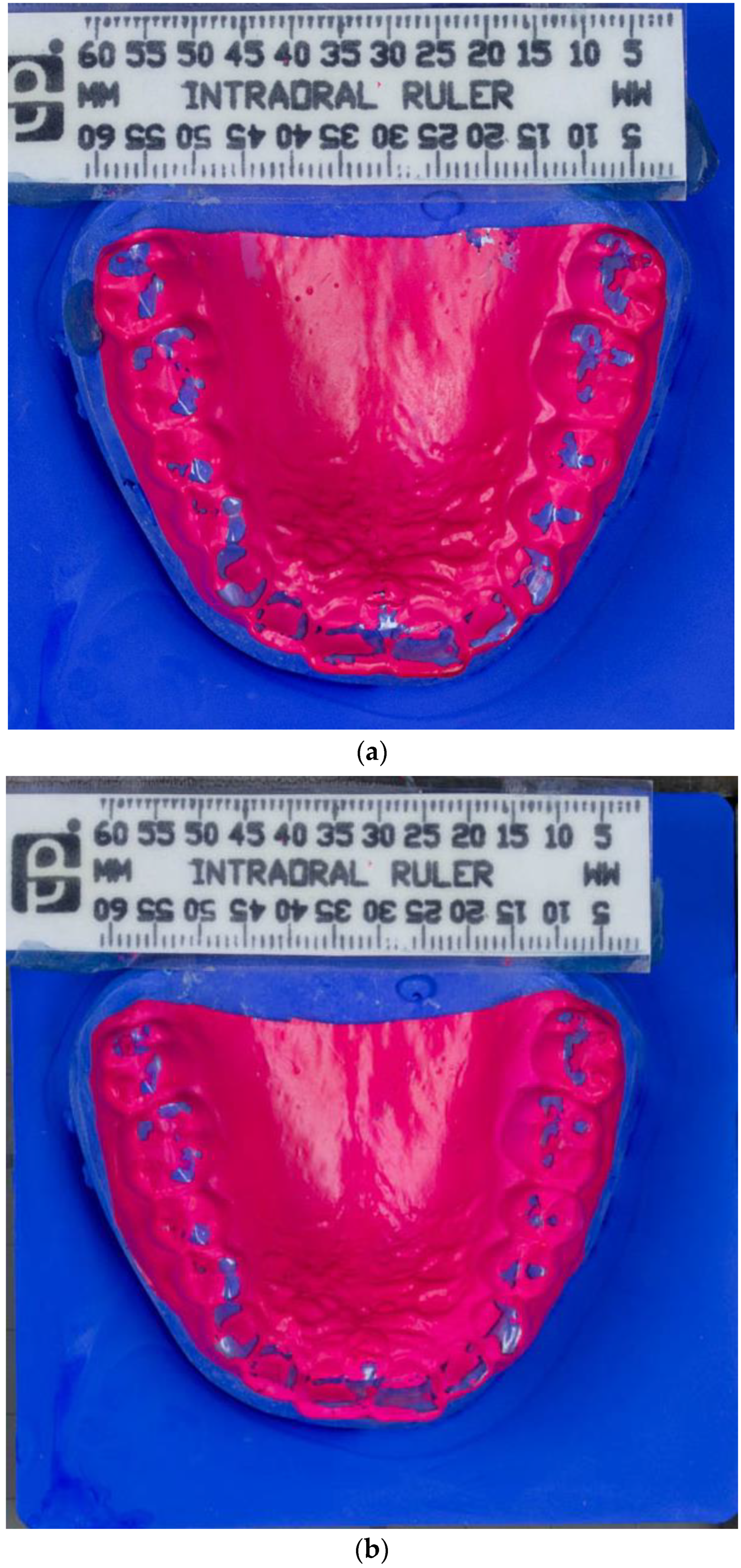 Diagnostics 13 00172 g001 Diagnostics 13 00172 g001