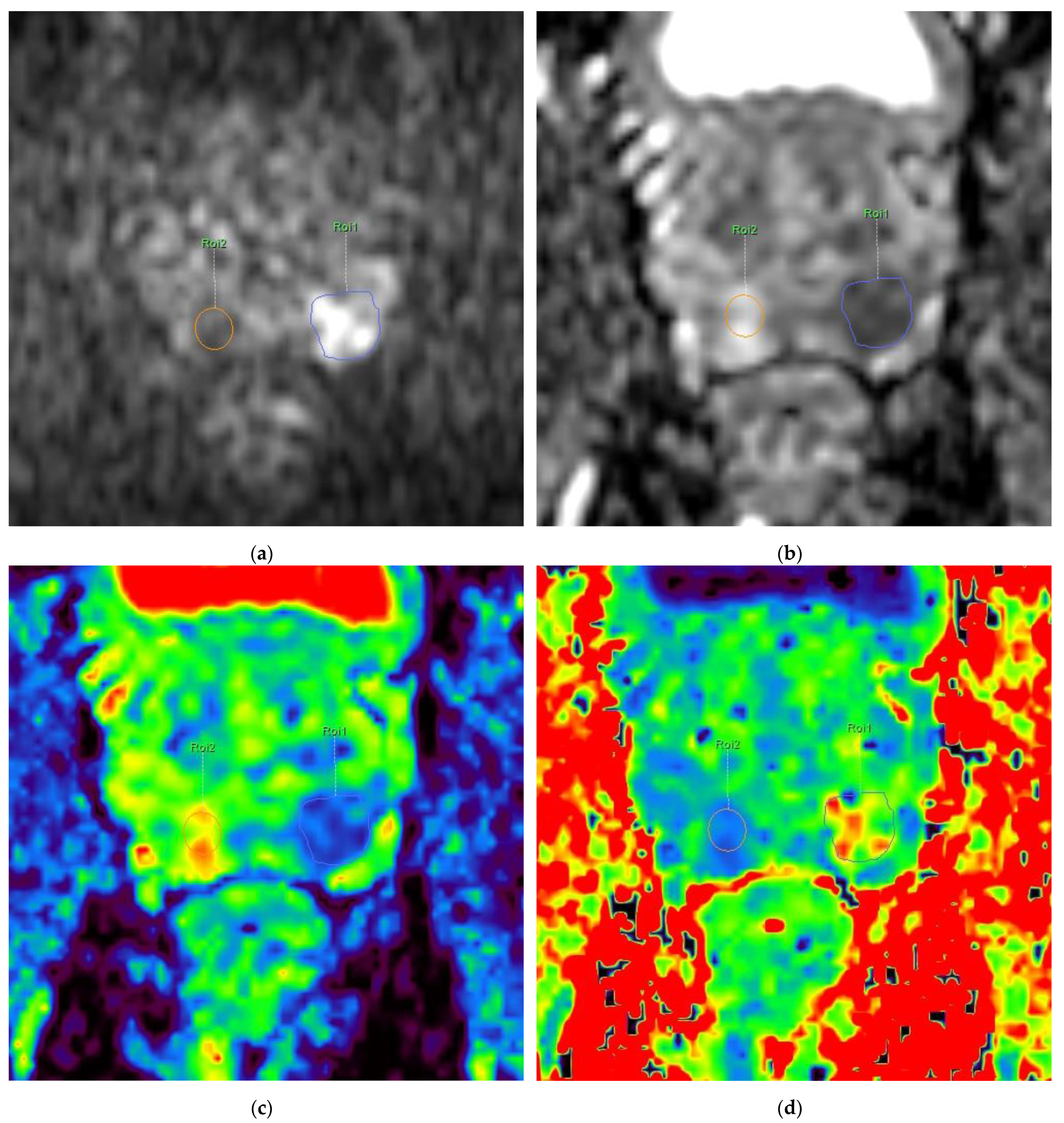 Diagnostics 13 00173 g001a