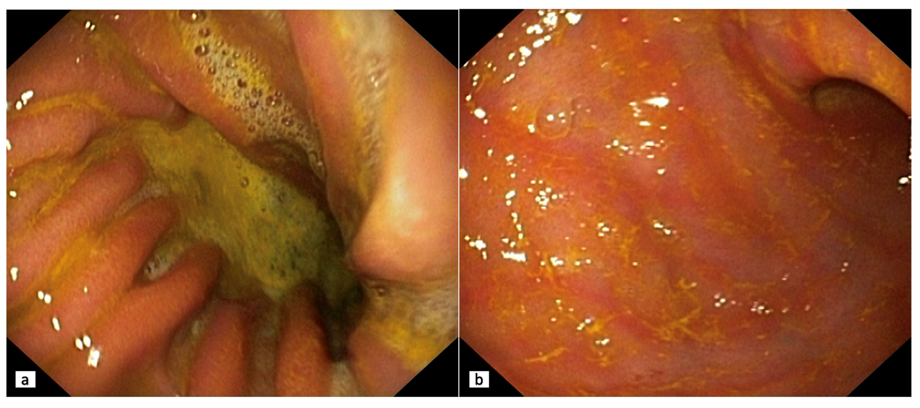 Diagnostics 13 00186 g002 Diagnostics 13 00186 g002