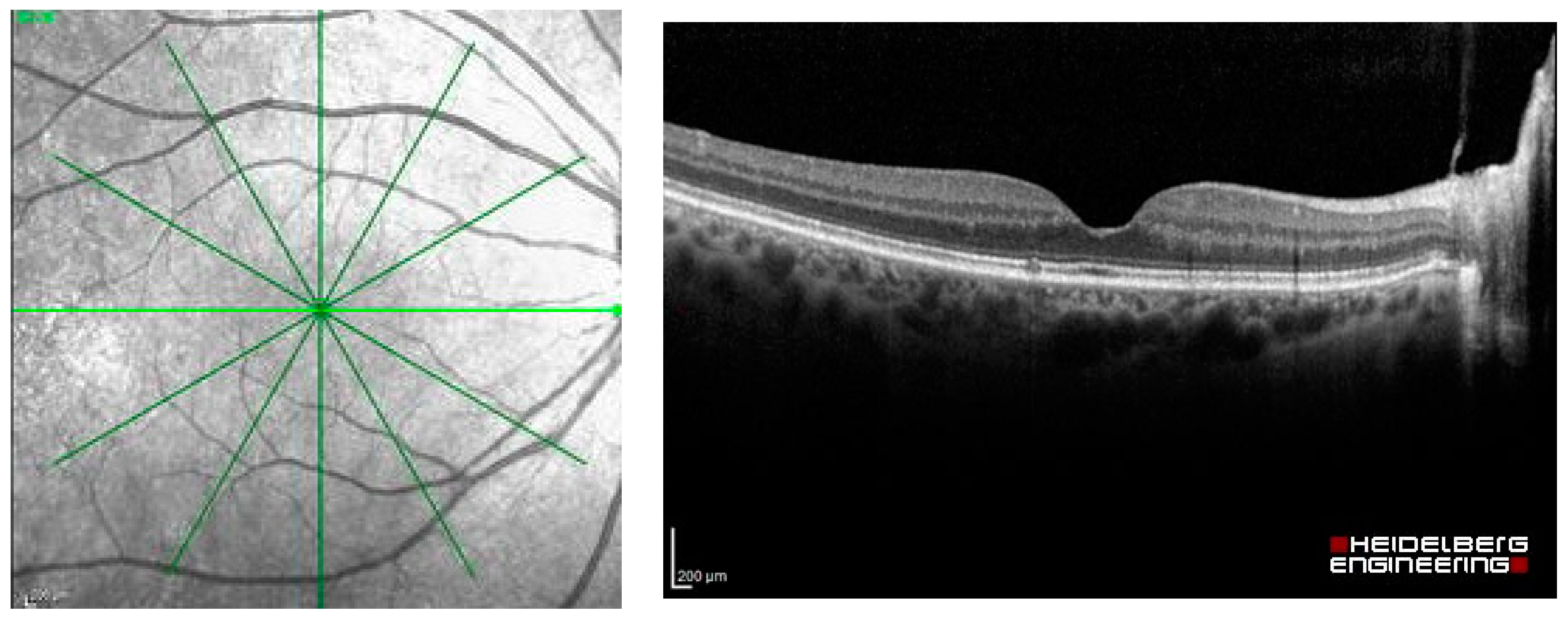Diagnostics 13 00189 g002