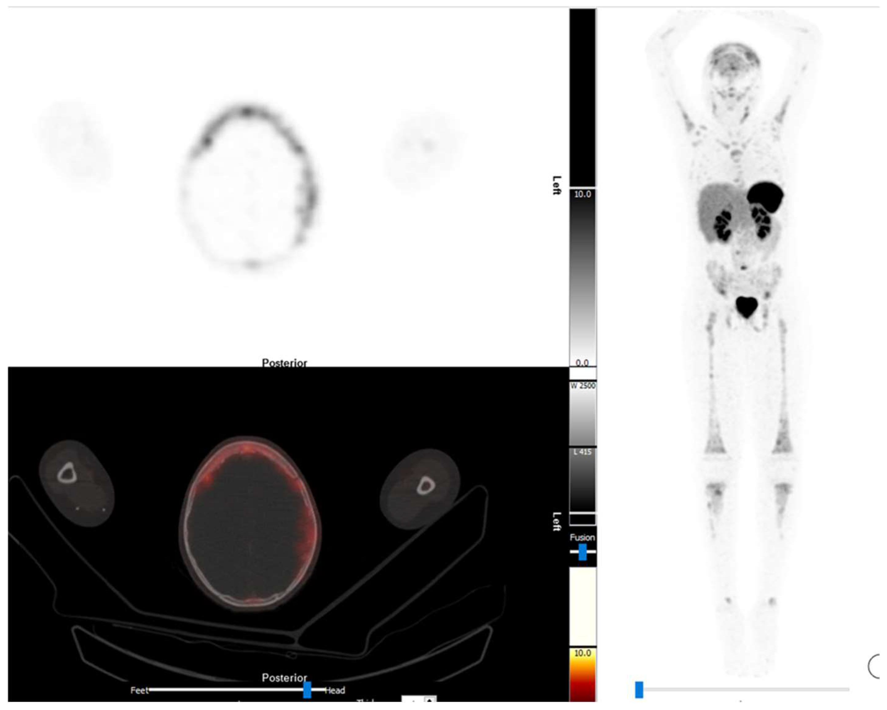 Diagnostics 13 00192 g002 Diagnostics 13 00192 g002