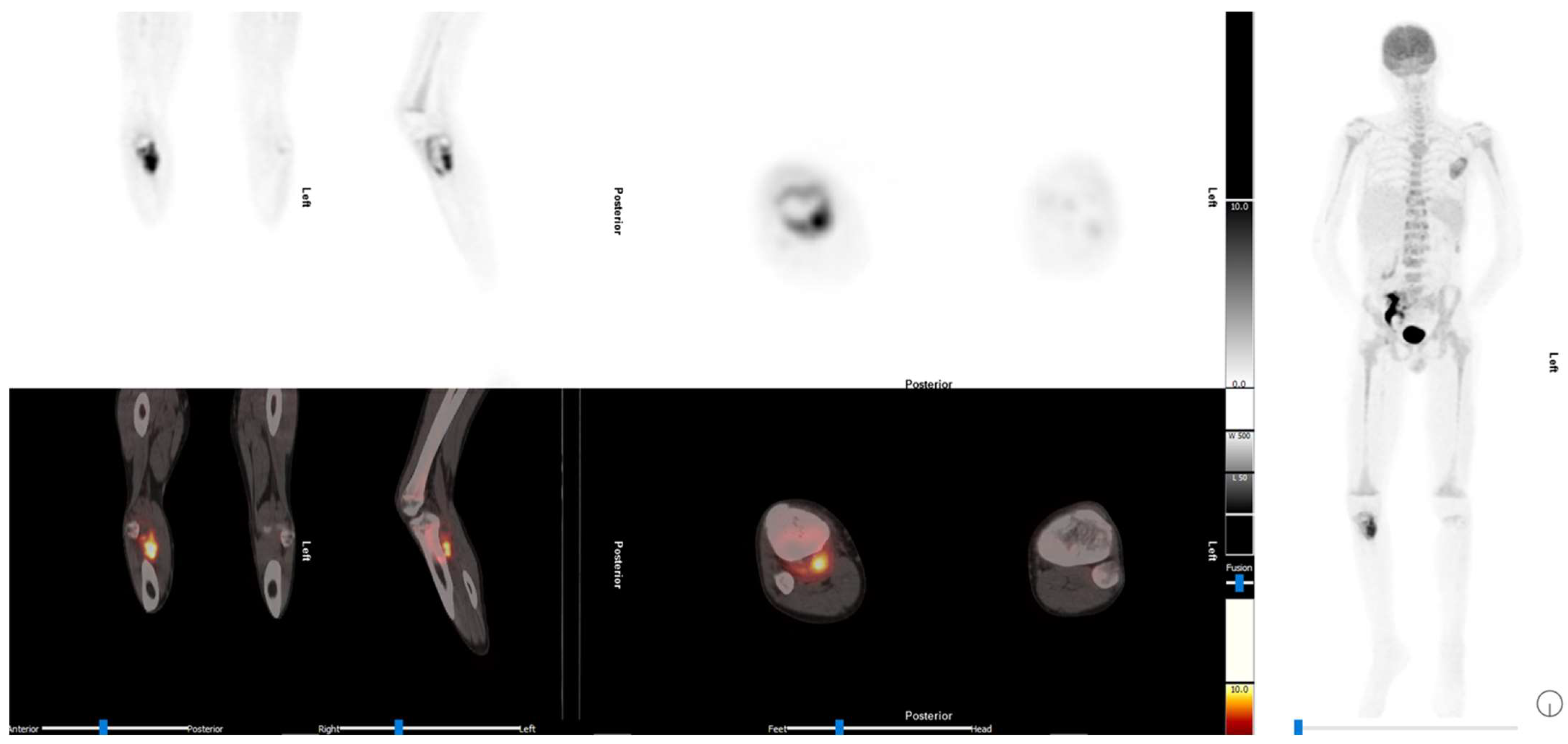 Diagnostics 13 00192 g003 Diagnostics 13 00192 g003