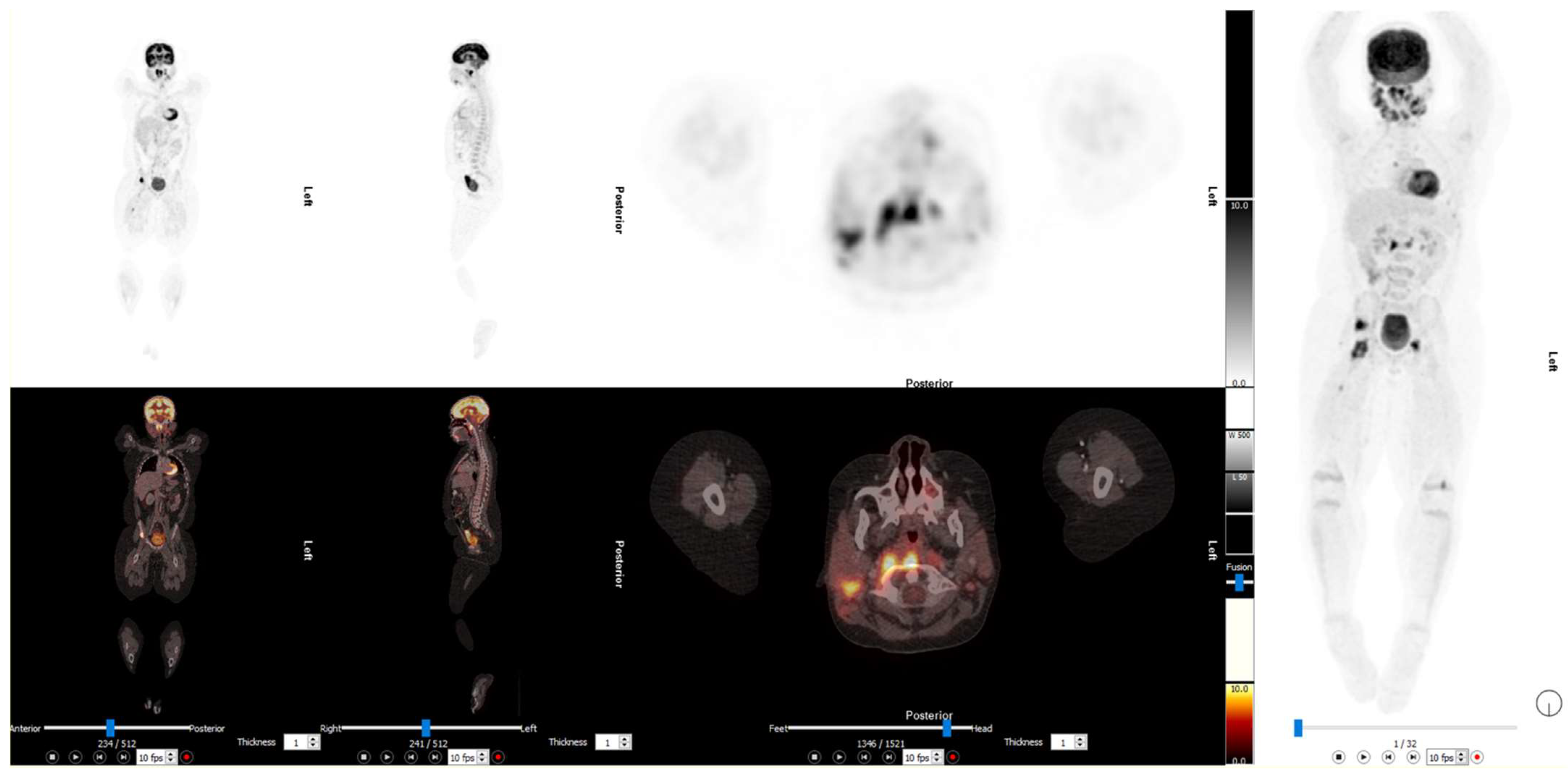 Diagnostics 13 00192 g004 Diagnostics 13 00192 g004