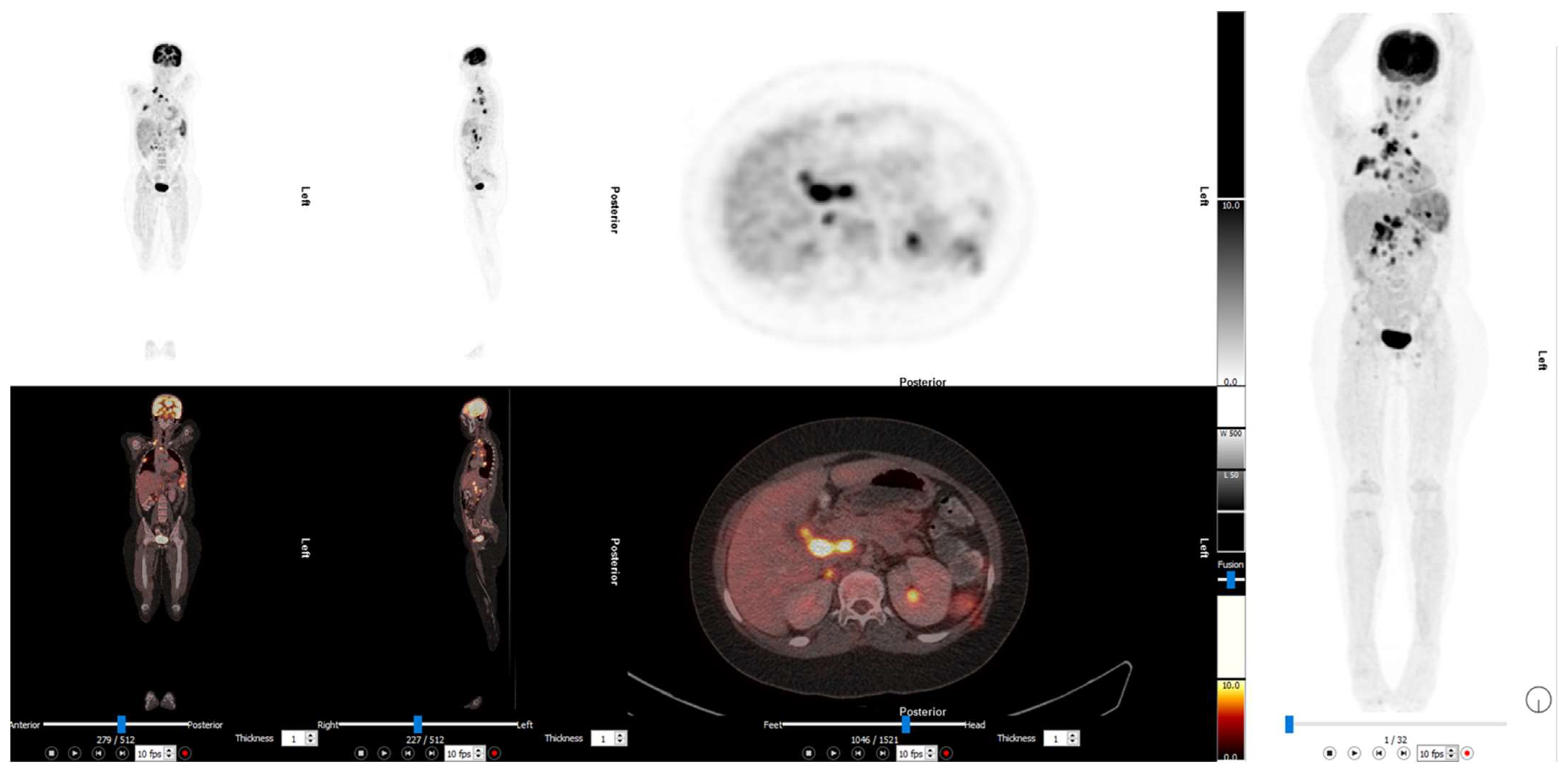 Diagnostics 13 00192 g005 Diagnostics 13 00192 g005