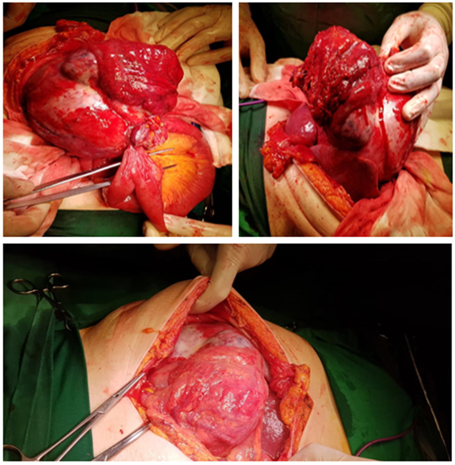 Diagnostics 13 00194 g002 Diagnostics 13 00194 g002