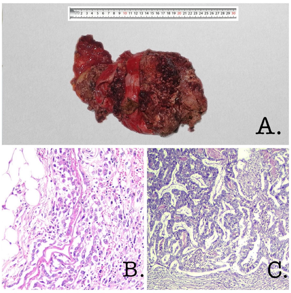 Diagnostics 13 00194 g003 Diagnostics 13 00194 g003