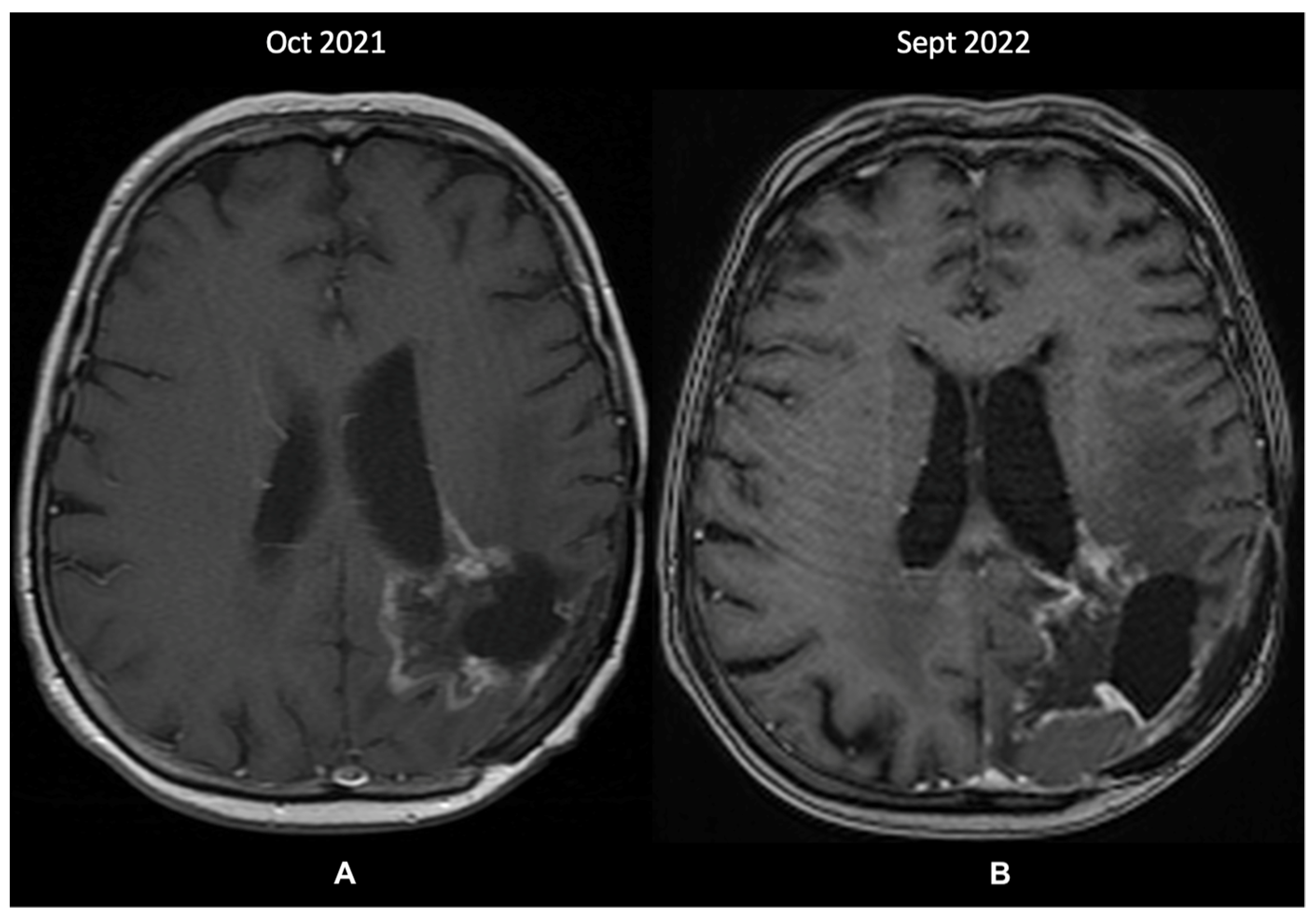 Diagnostics 13 00197 g004 Diagnostics 13 00197 g004