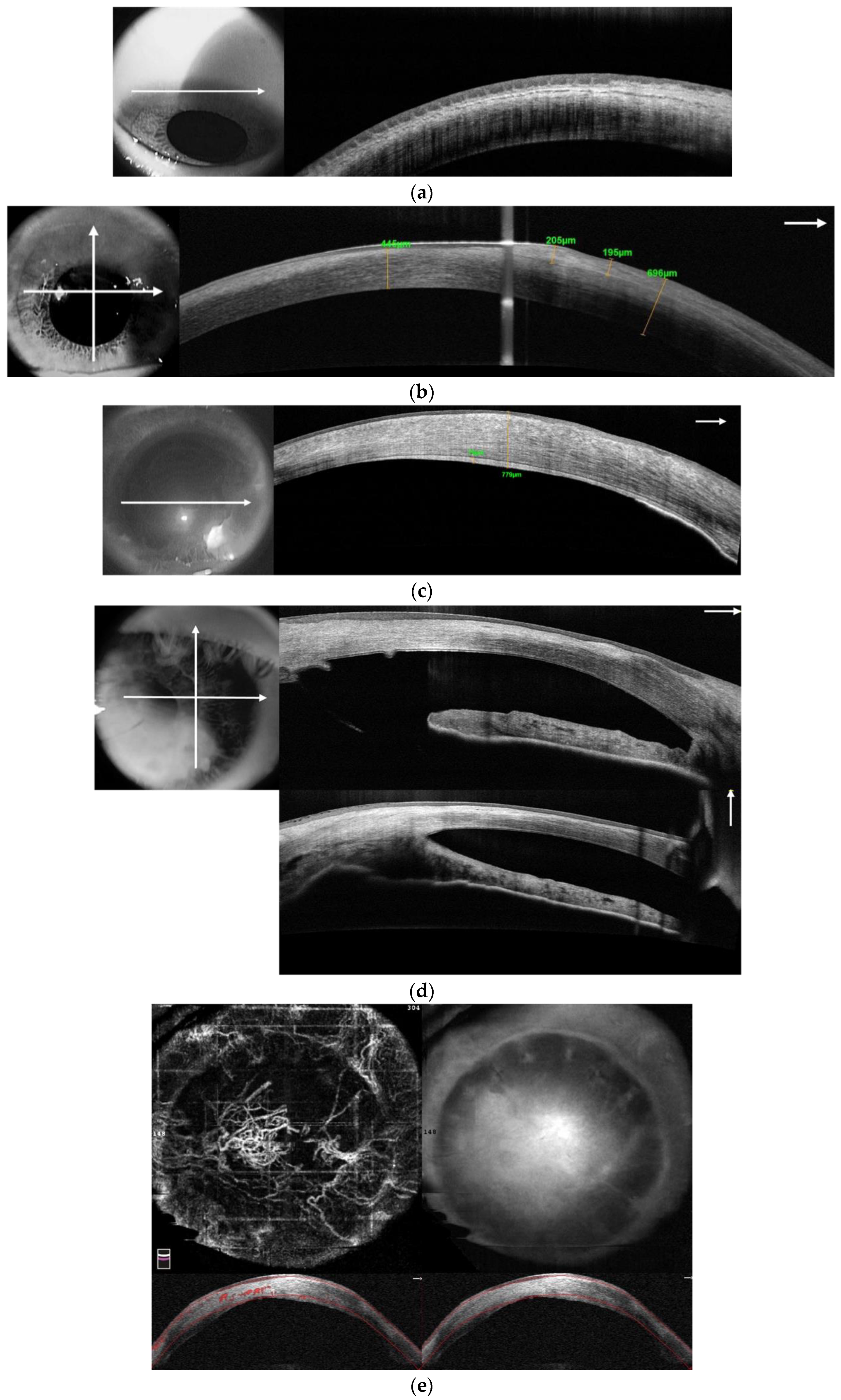Diagnostics 13 00199 g004