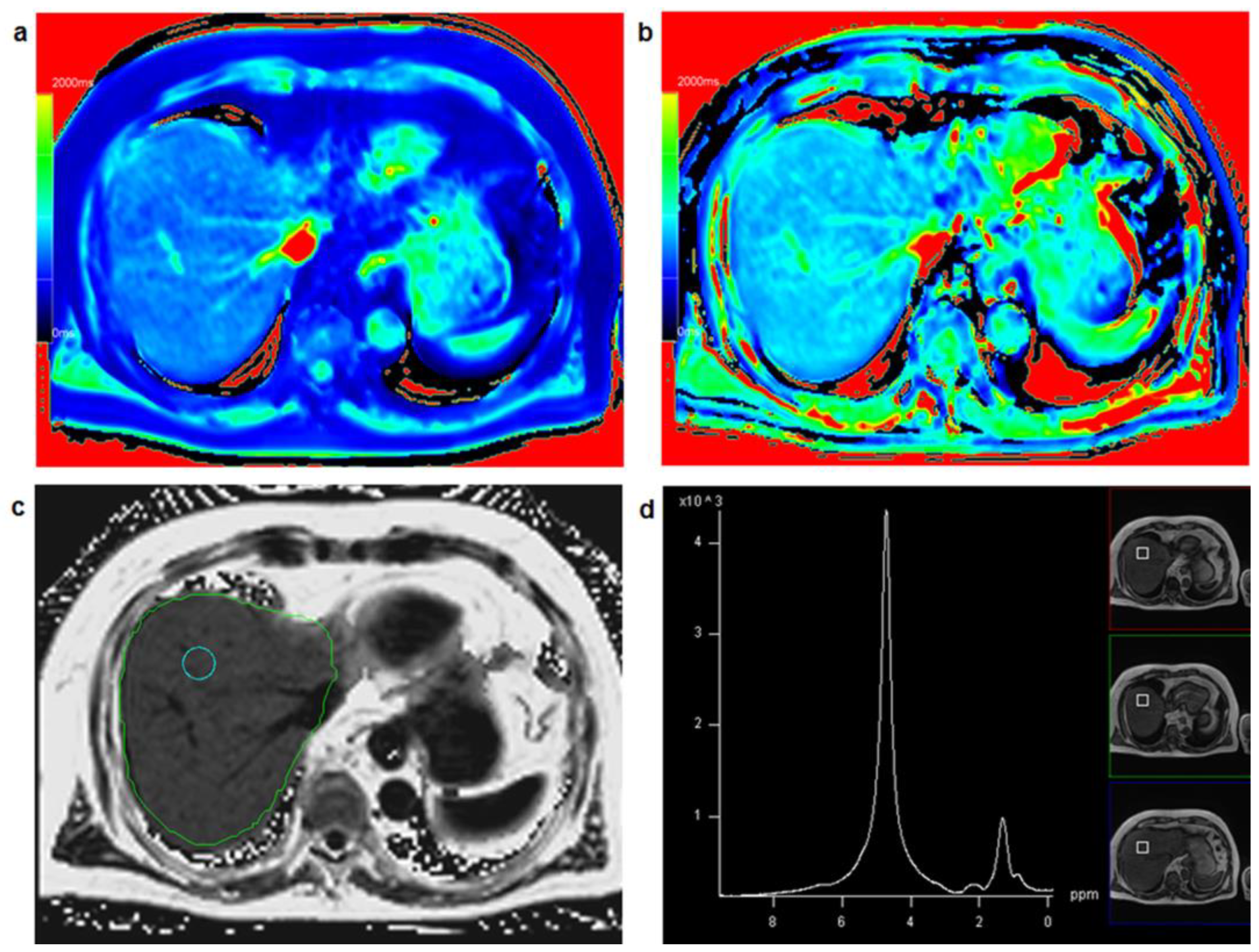 Diagnostics 13 00201 g003 Diagnostics 13 00201 g003