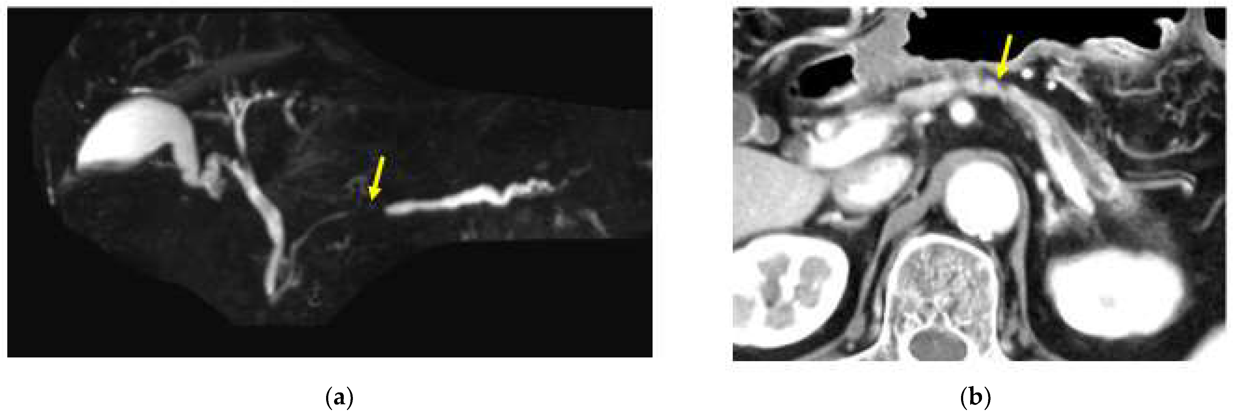 Diagnostics 13 00215 g003