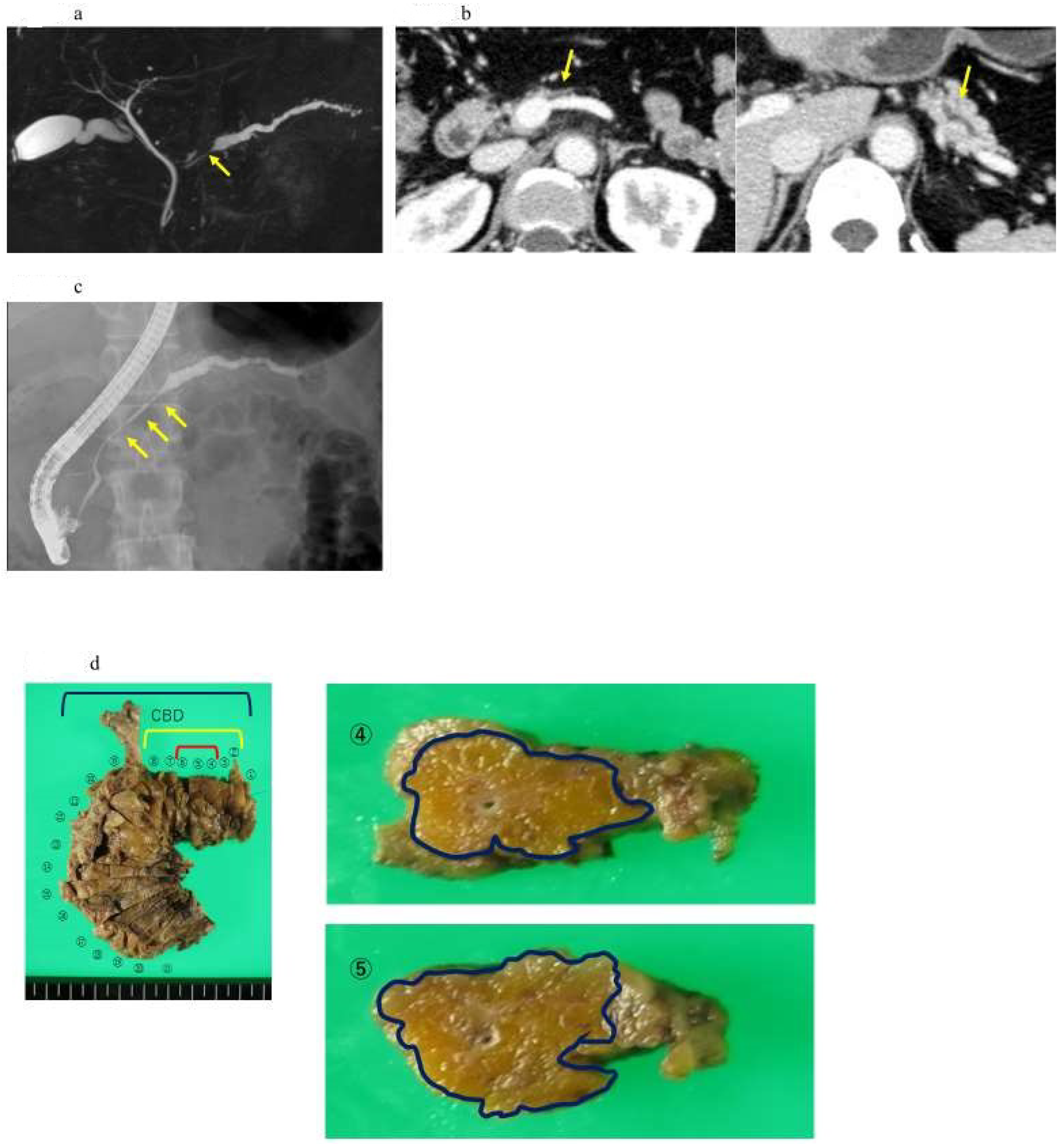 Diagnostics 13 00215 g004a