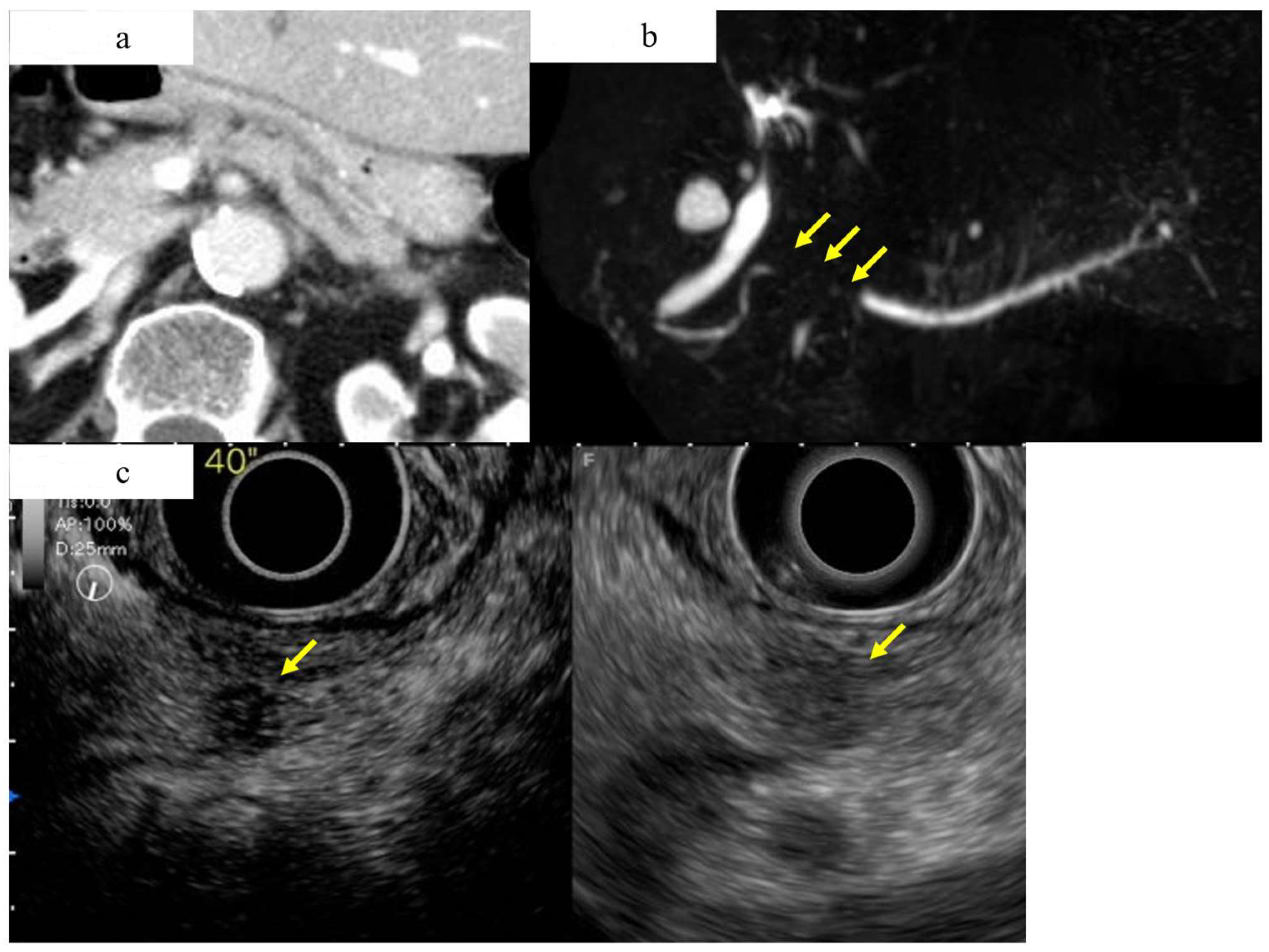 Diagnostics 13 00215 g005