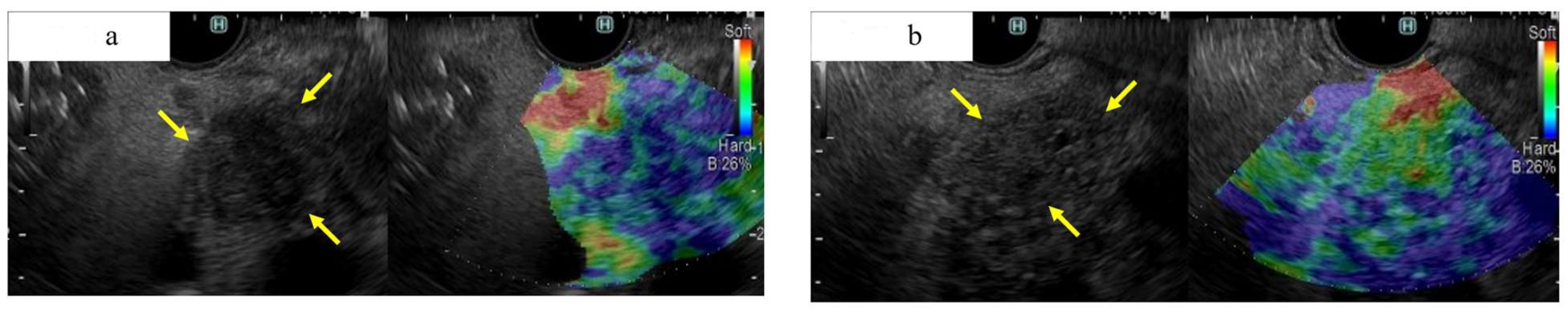 Diagnostics 13 00215 g006