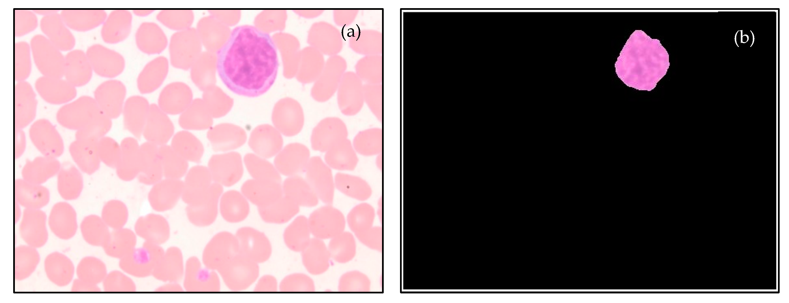 Diagnostics 13 00220 g007 Diagnostics 13 00220 g007