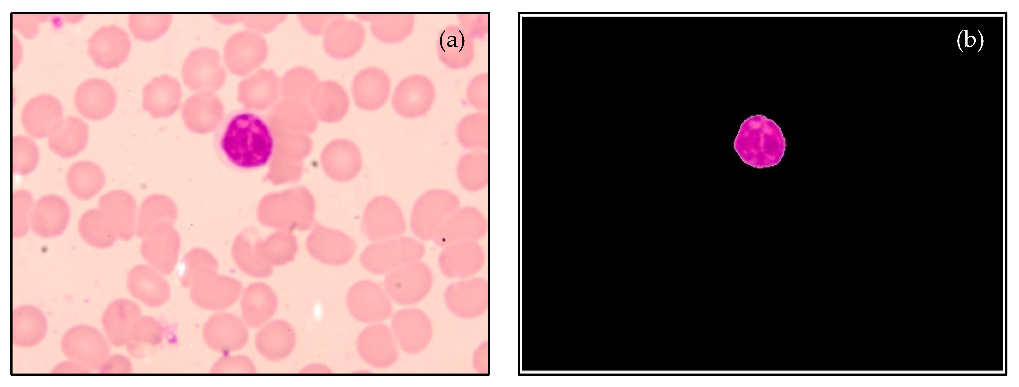 Diagnostics 13 00220 g008 Diagnostics 13 00220 g008
