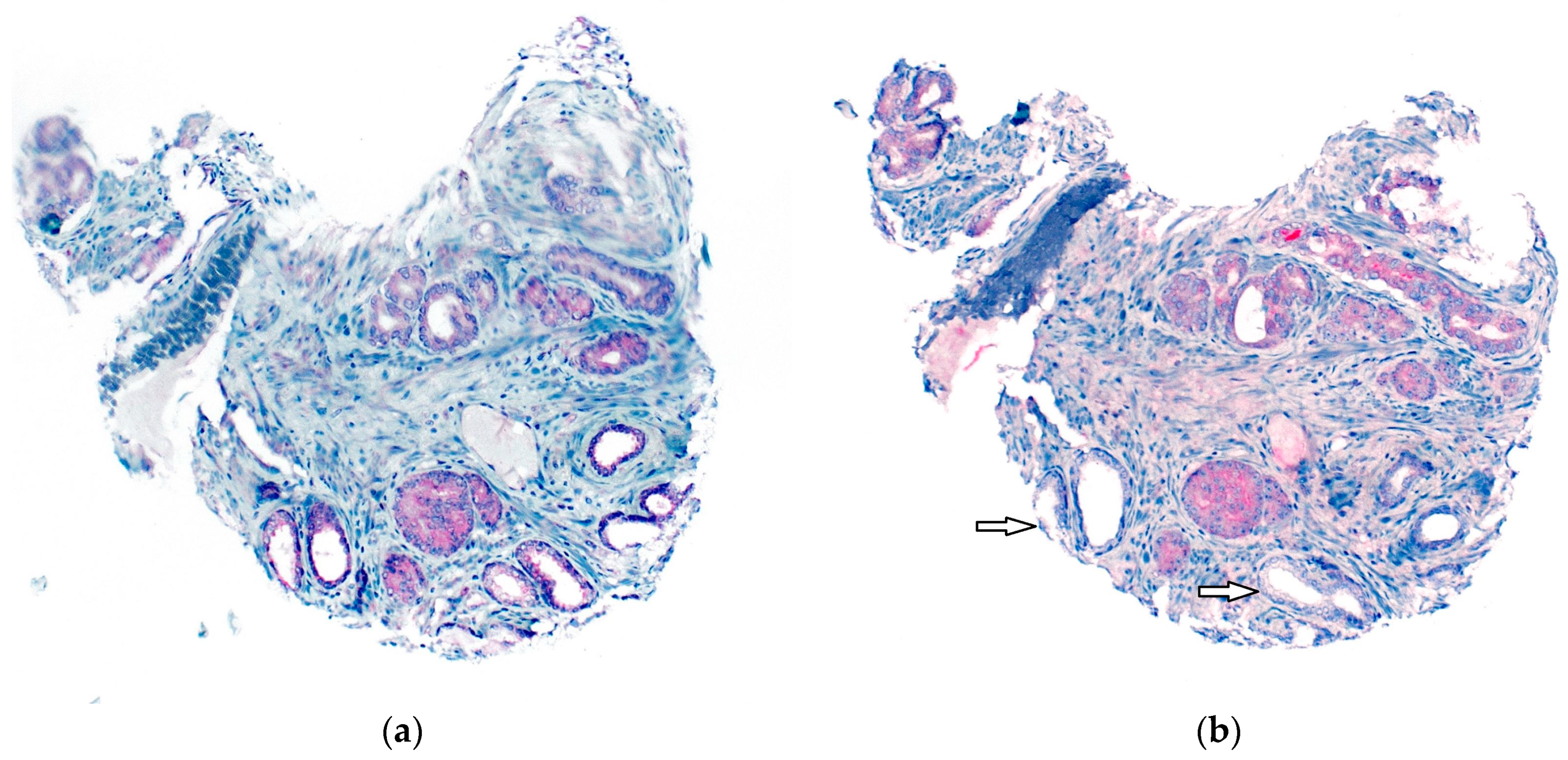 Diagnostics 13 00221 g004 Diagnostics 13 00221 g004