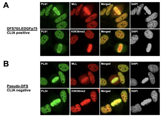 The Nuclear Dense Fine Speckled (DFS) Immunofluorescence Pattern: Not ...