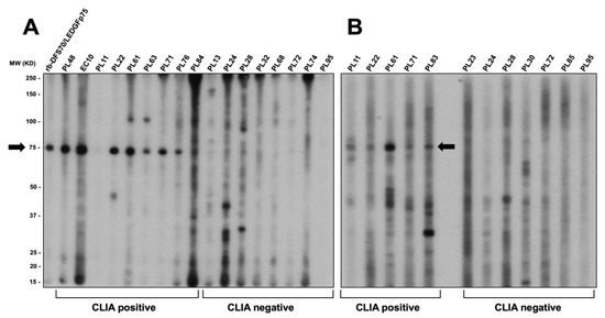The Nuclear Dense Fine Speckled (DFS) Immunofluorescence Pattern: Not ...