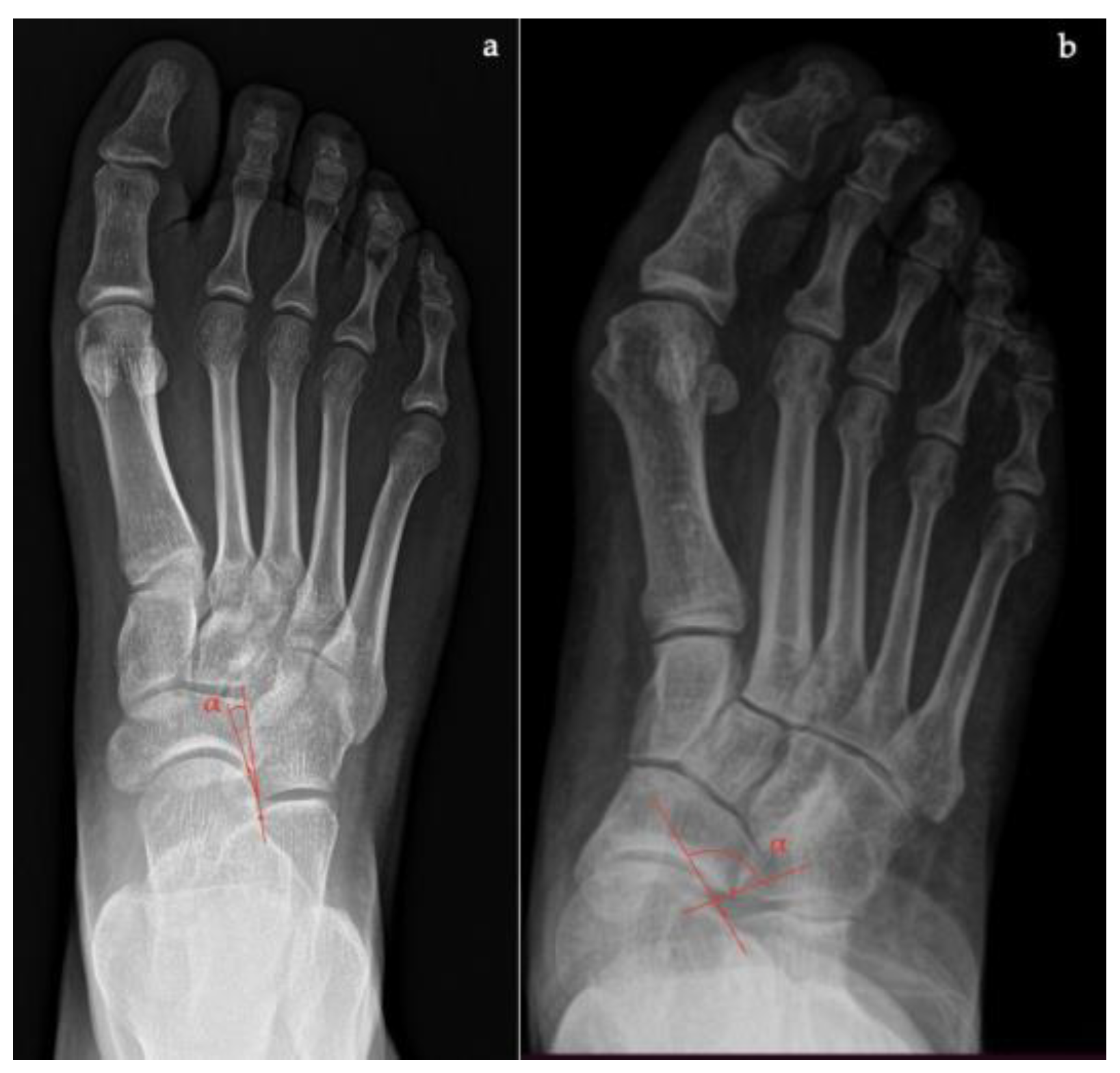 Diagnostics 13 00225 g004 Diagnostics 13 00225 g004