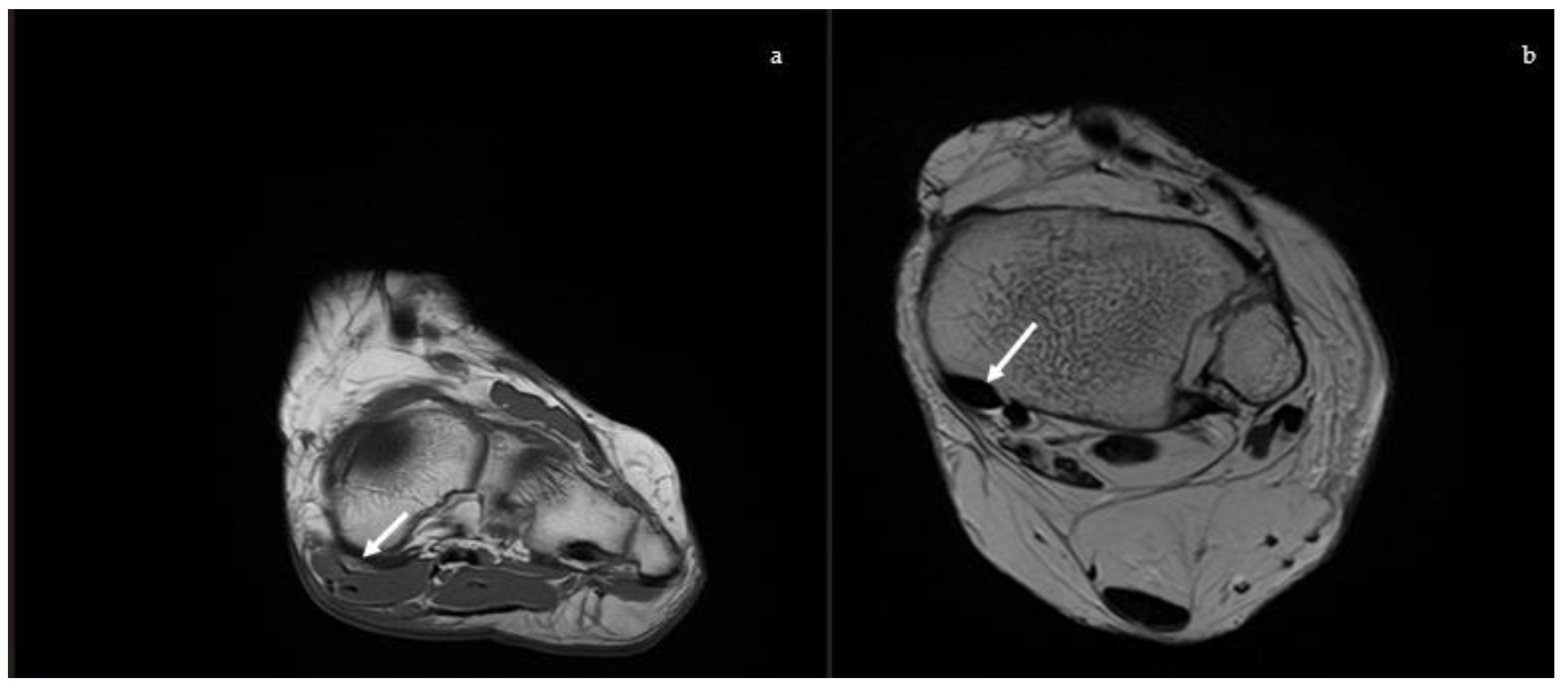 Diagnostics 13 00225 g010 Diagnostics 13 00225 g010
