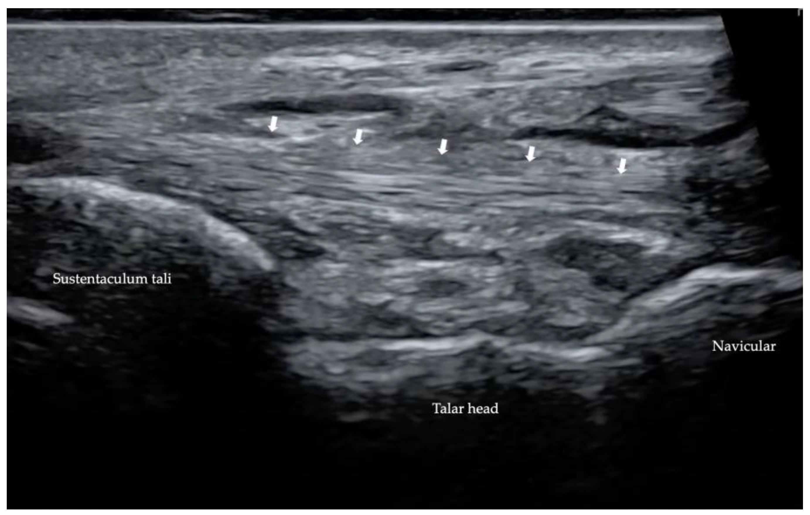 Diagnostics 13 00225 g011 Diagnostics 13 00225 g011