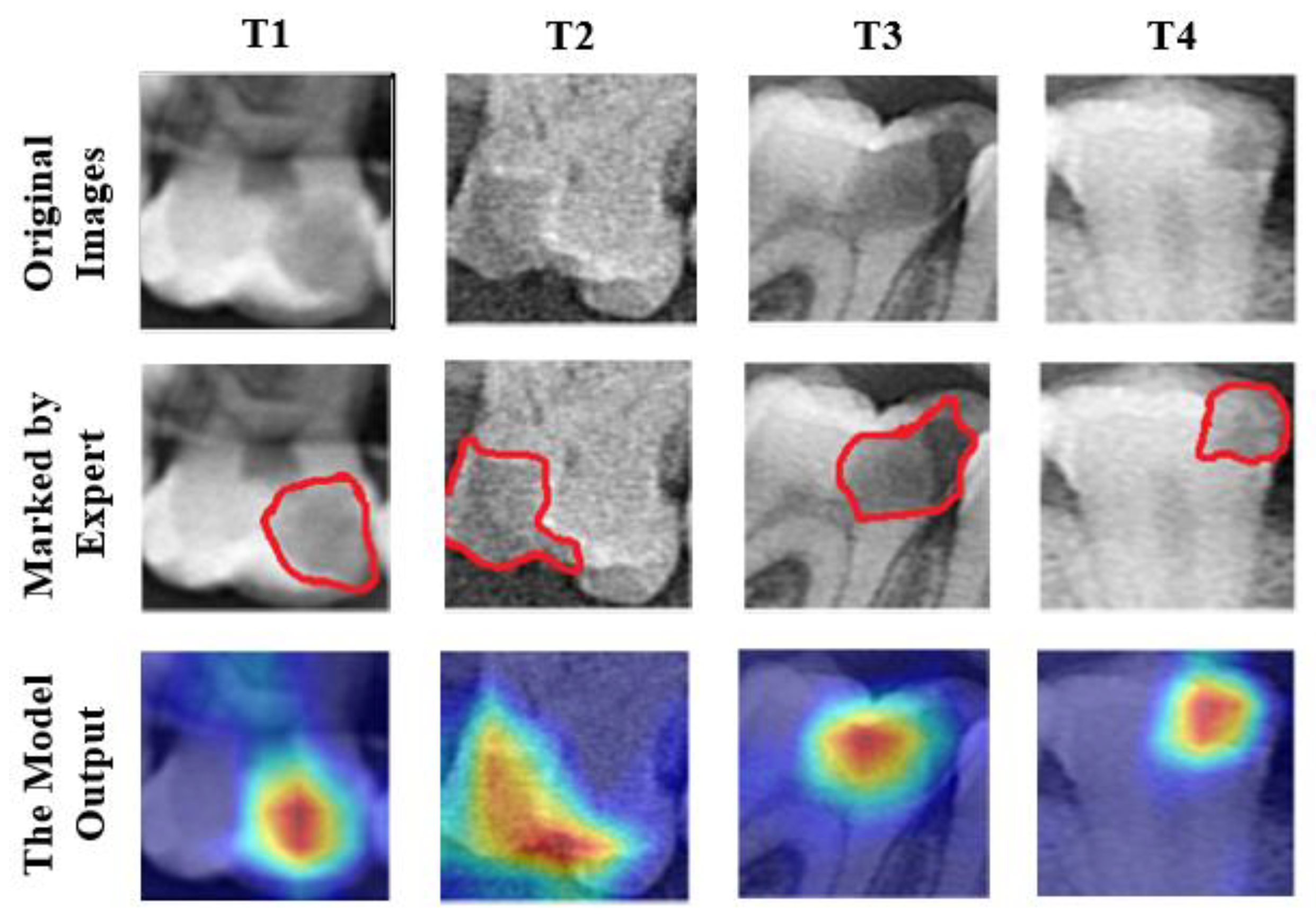 Diagnostics 13 00226 g009 Diagnostics 13 00226 g009