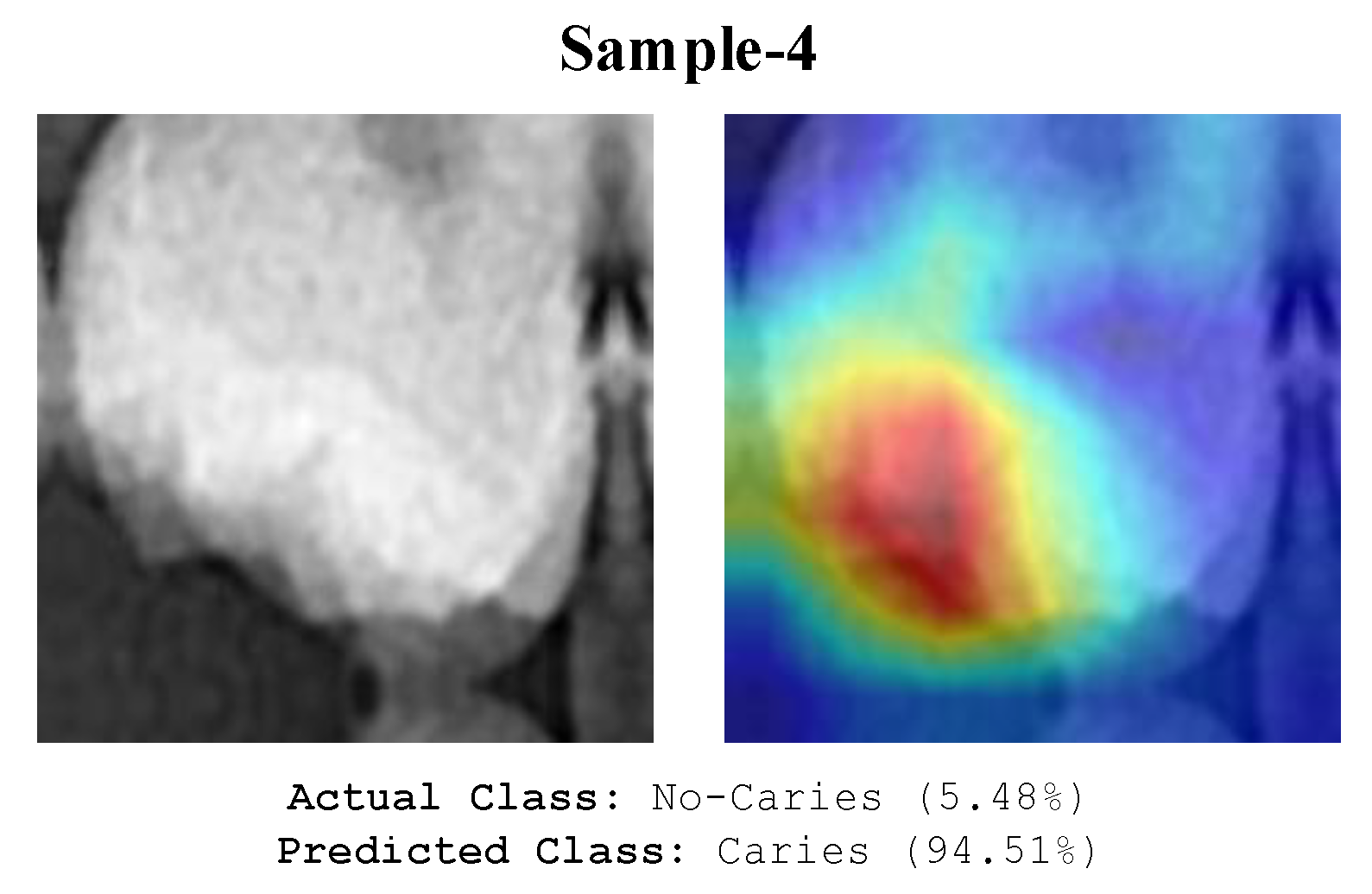 Diagnostics 13 00226 g011 Diagnostics 13 00226 g011