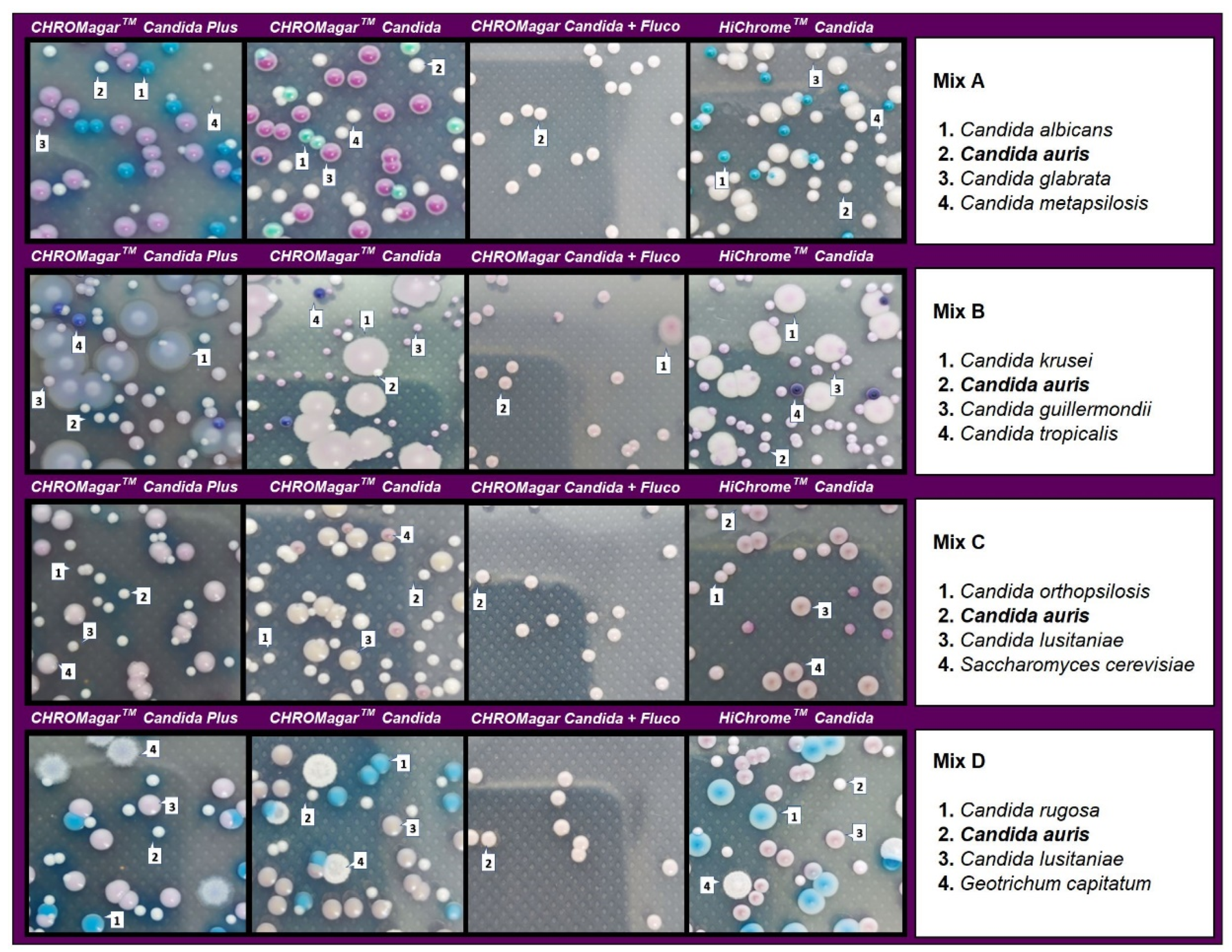Diagnostics 13 00231 g004 Diagnostics 13 00231 g004