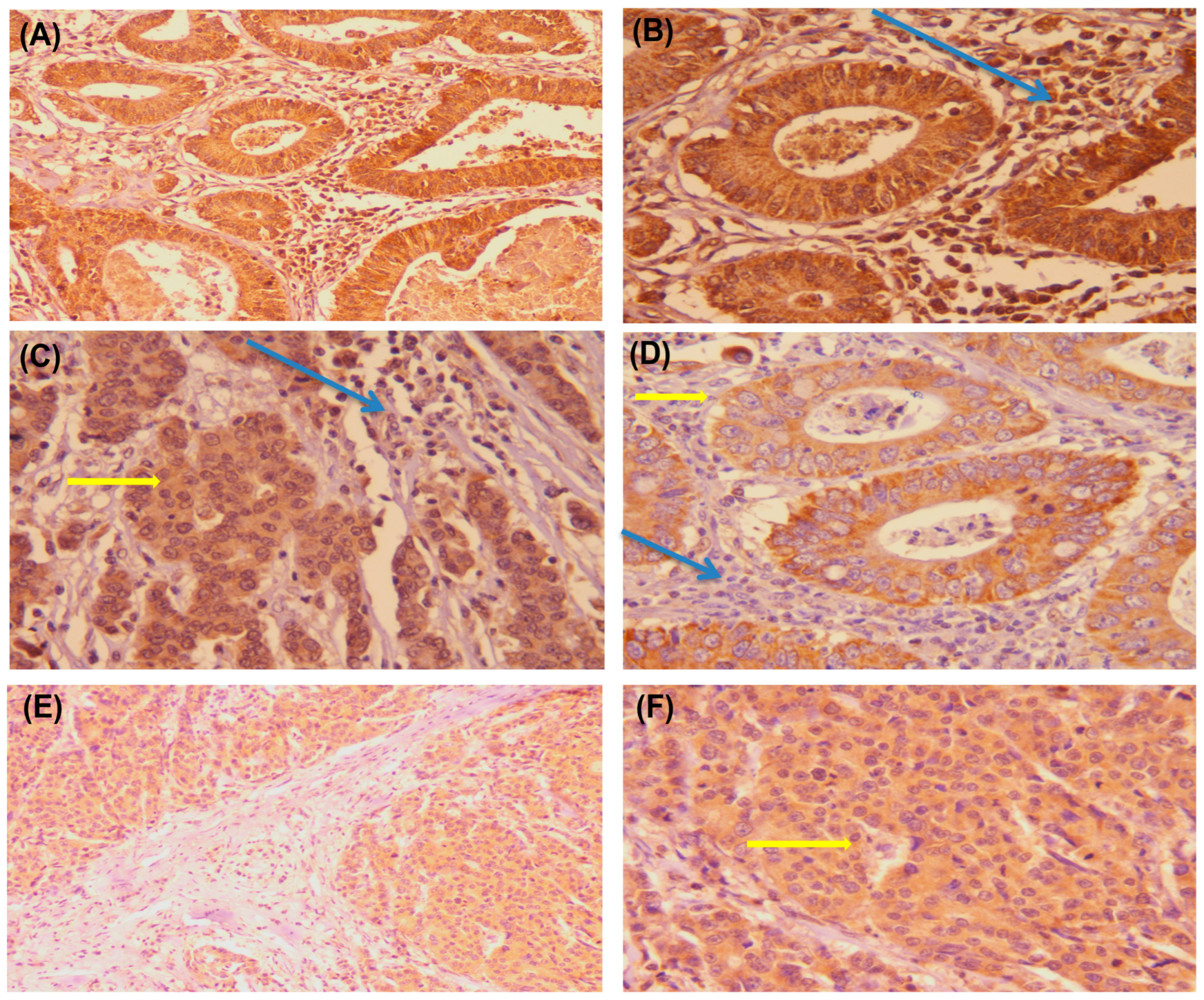 Diagnostics 13 00237 g004