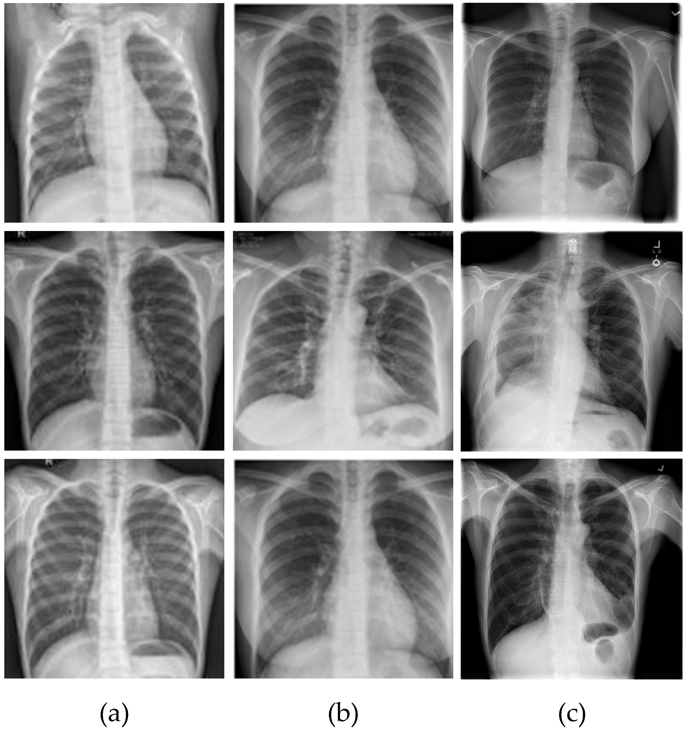 Automated Pneumonia Based Lung Diseases Classification with Robust ...