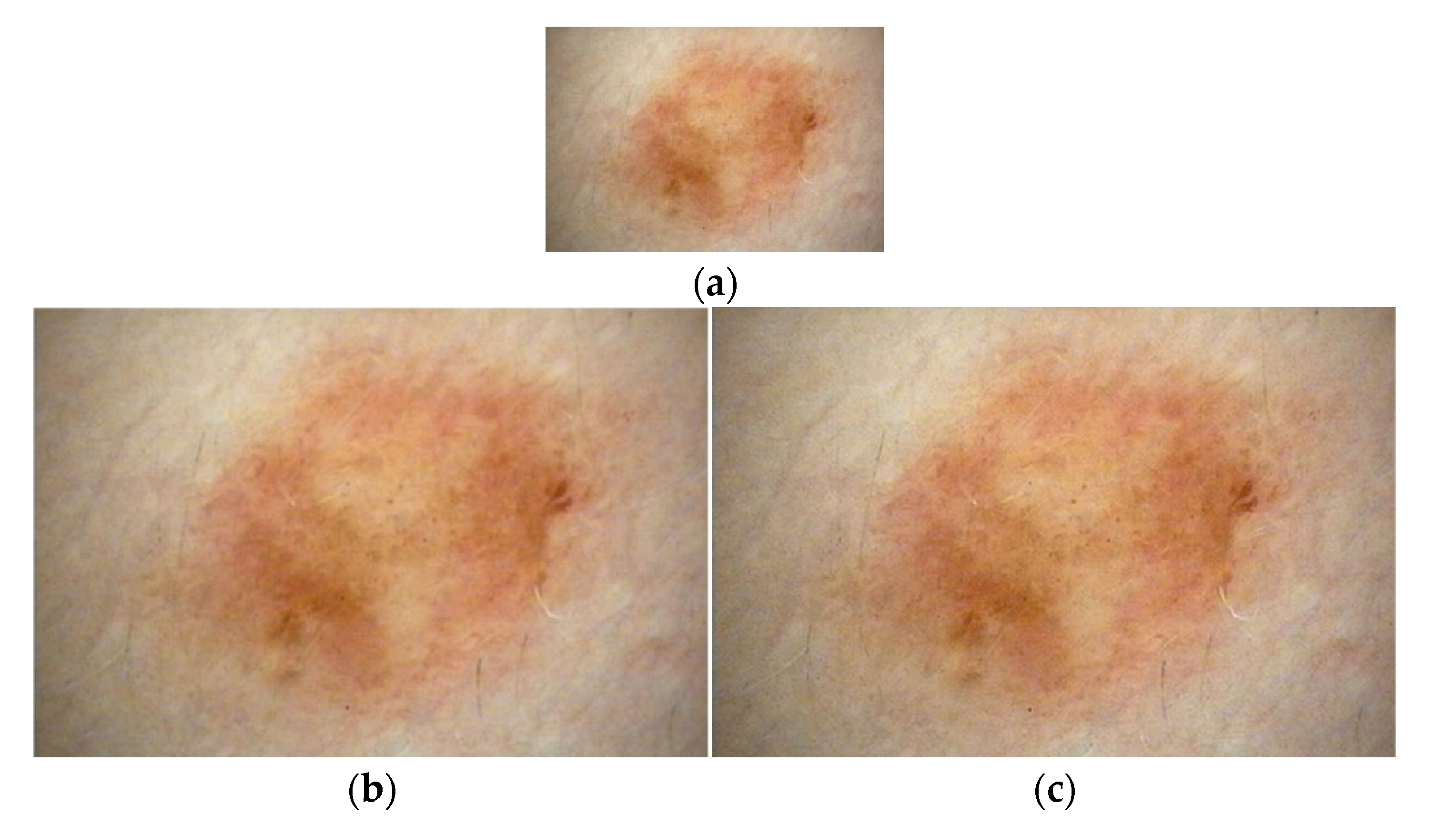 Diagnostics 13 00262 g004