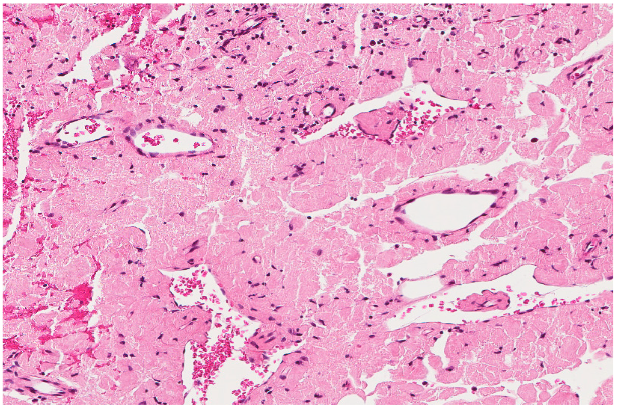 Diagnostics 13 00271 g010