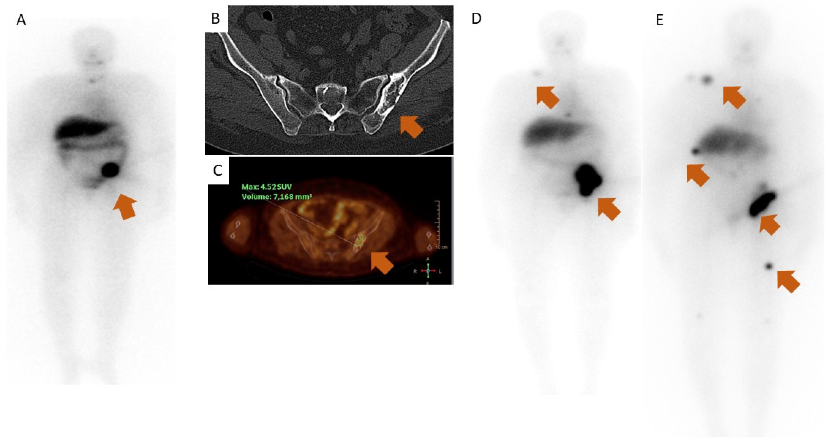 Diagnostics Free FullText Delayed Presentation of Functioning