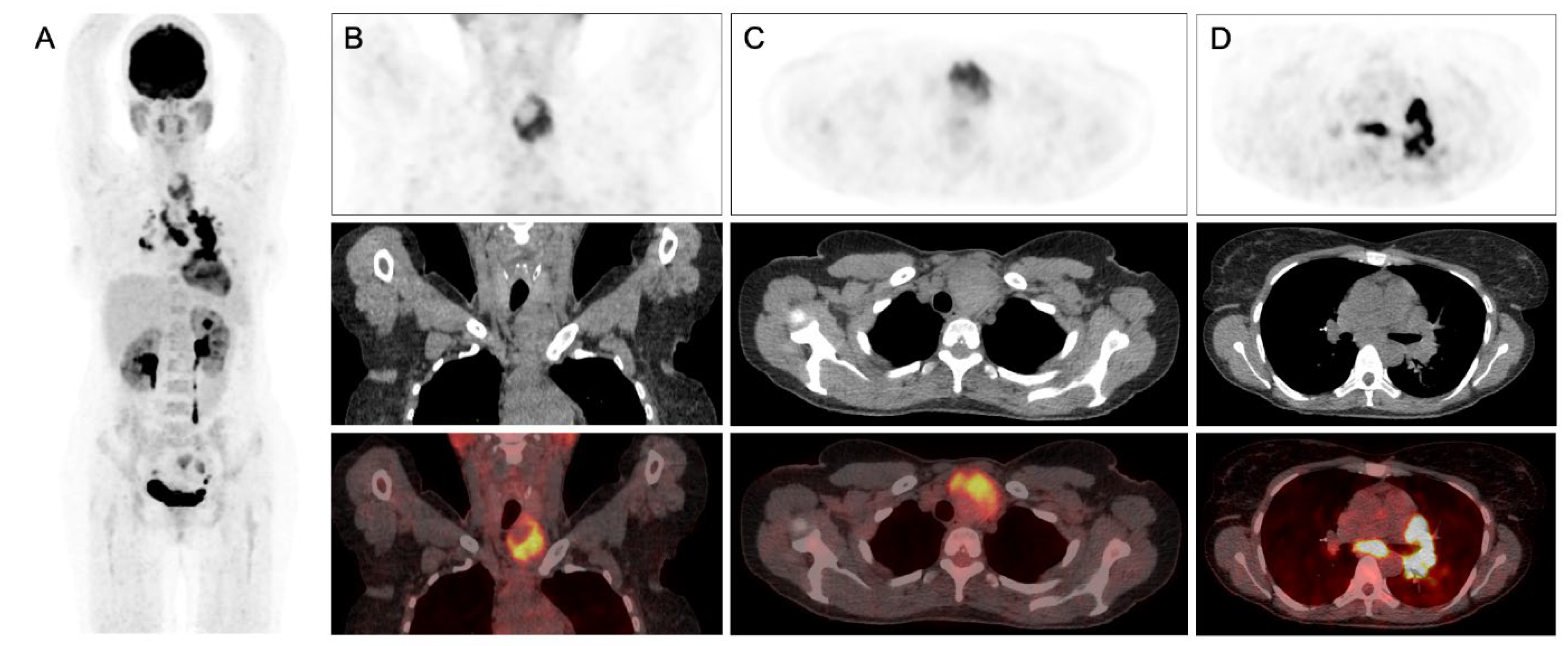 Diagnostics Free Full Text An Exceptional Cause Of Increased 18F diagnostics-free-full-text-an-exceptional-cause-of-increased-18f