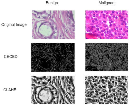 Diagnostics | Free Full-Text | Lightweight Separable Convolution ...
