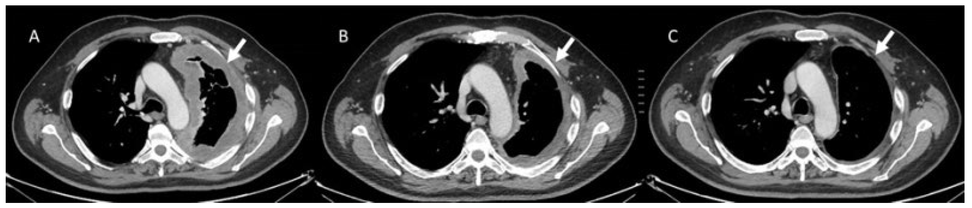 Diagnostics 13 00302 g001 Diagnostics 13 00302 g001