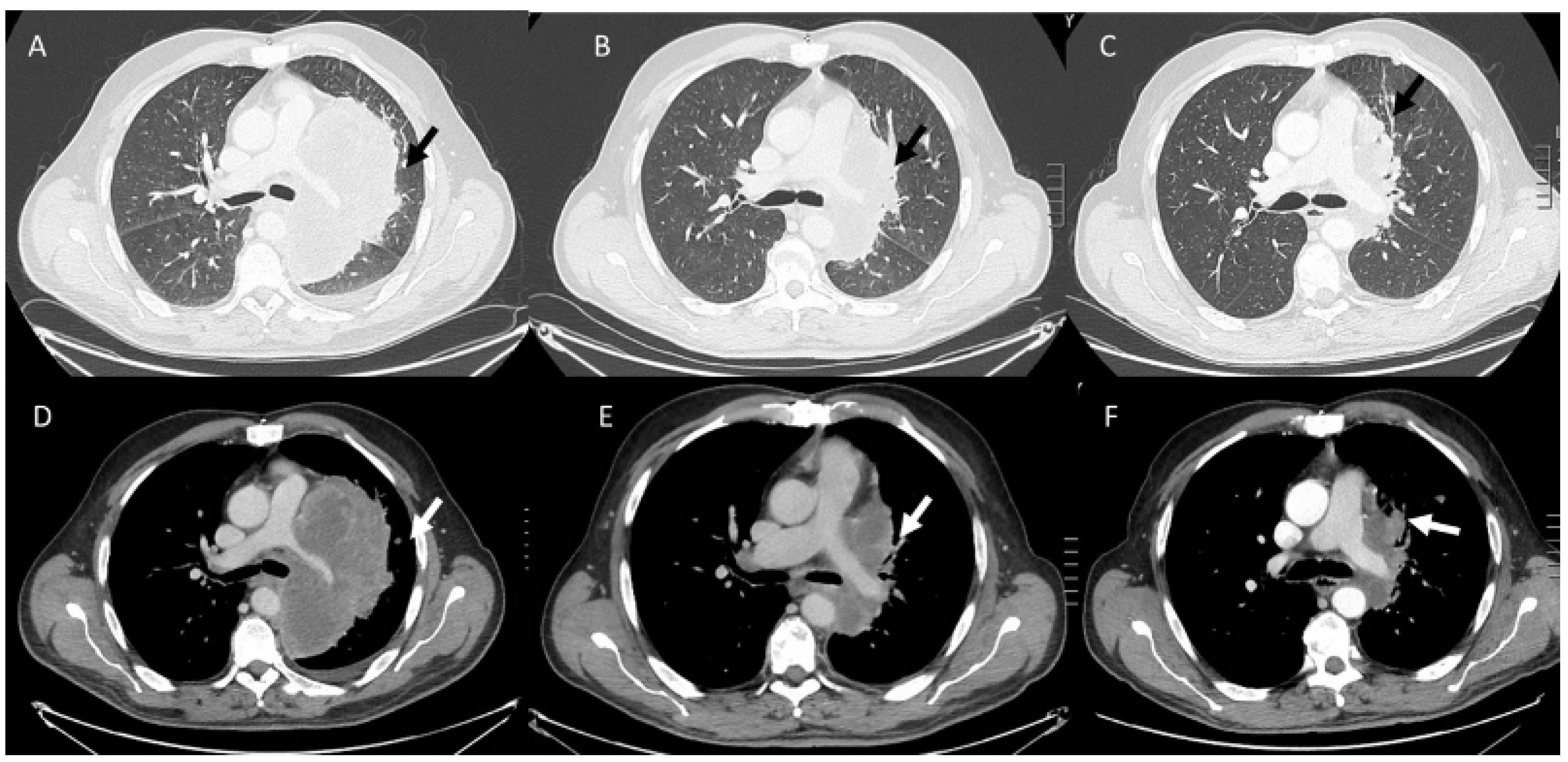 Diagnostics 13 00302 g002 Diagnostics 13 00302 g002