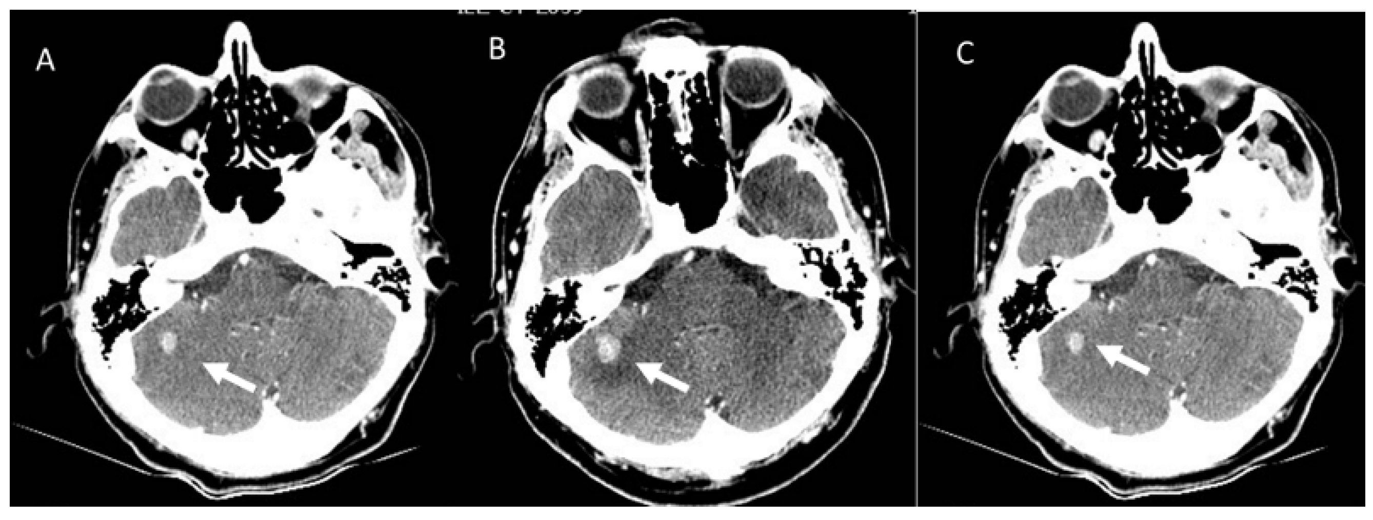 Diagnostics 13 00302 g003 Diagnostics 13 00302 g003