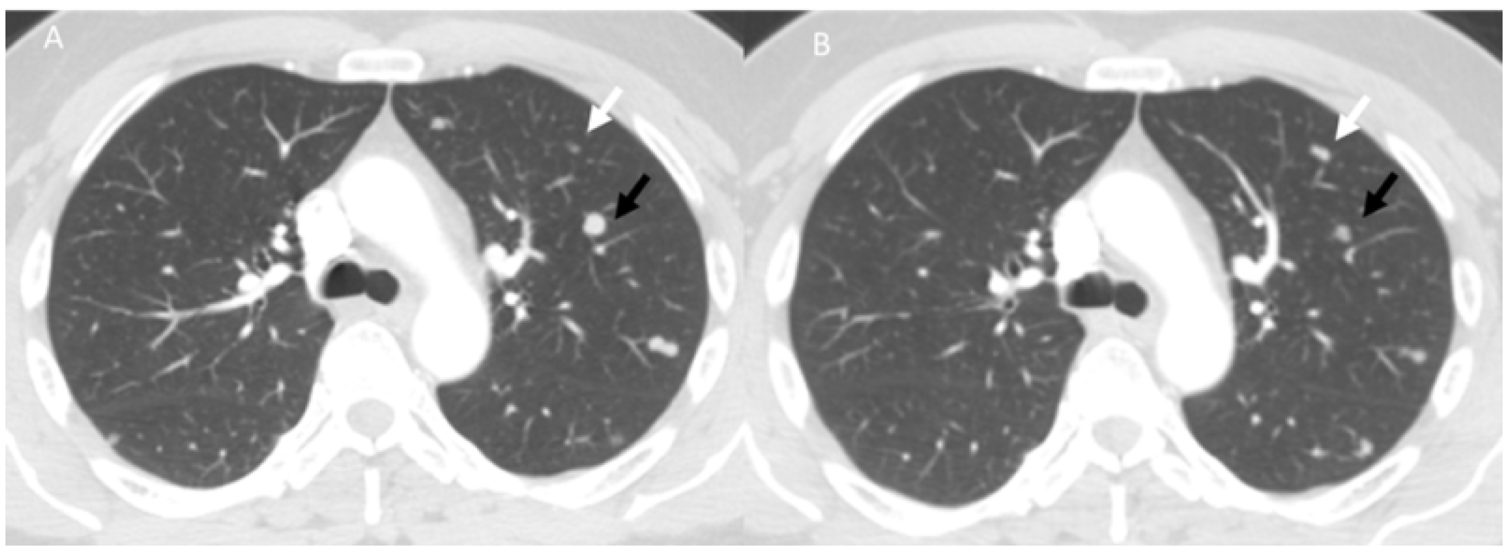 Diagnostics 13 00302 g006 Diagnostics 13 00302 g006