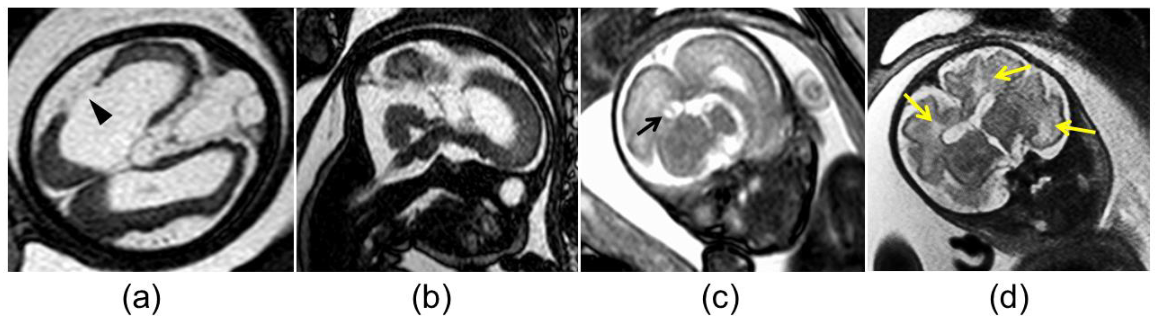 Diagnostics 13 00306 g002 Diagnostics 13 00306 g002