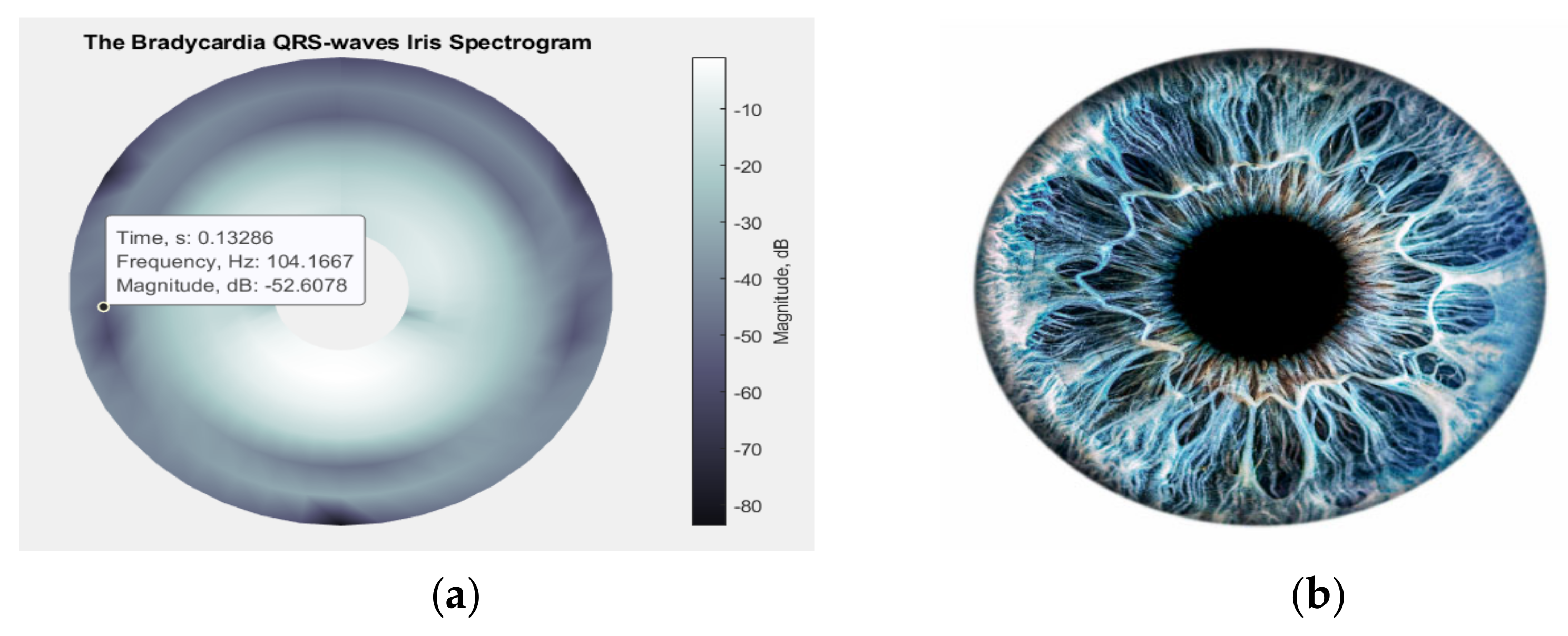 Diagnostics 13 00308 g006 Diagnostics 13 00308 g006