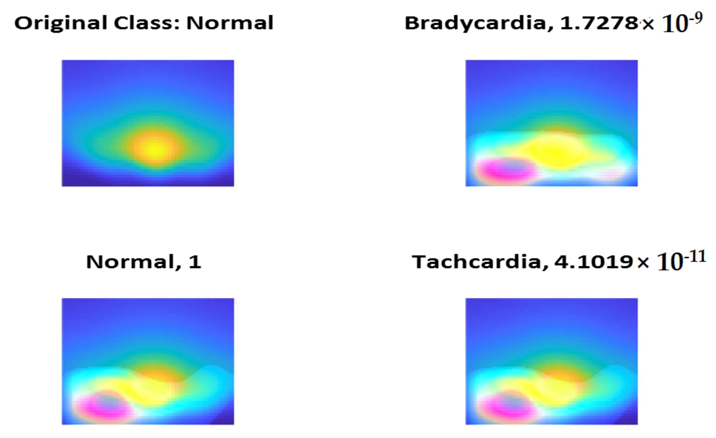Diagnostics 13 00308 g014 Diagnostics 13 00308 g014