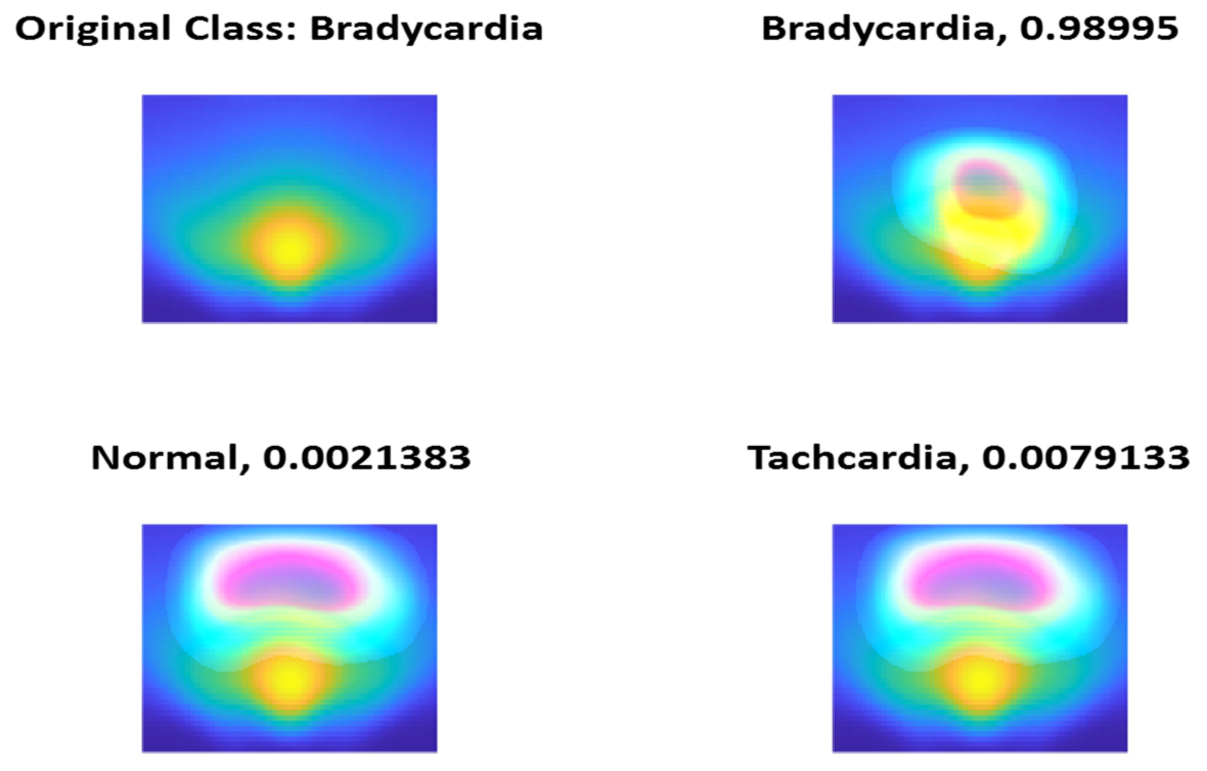 Diagnostics 13 00308 g015 Diagnostics 13 00308 g015