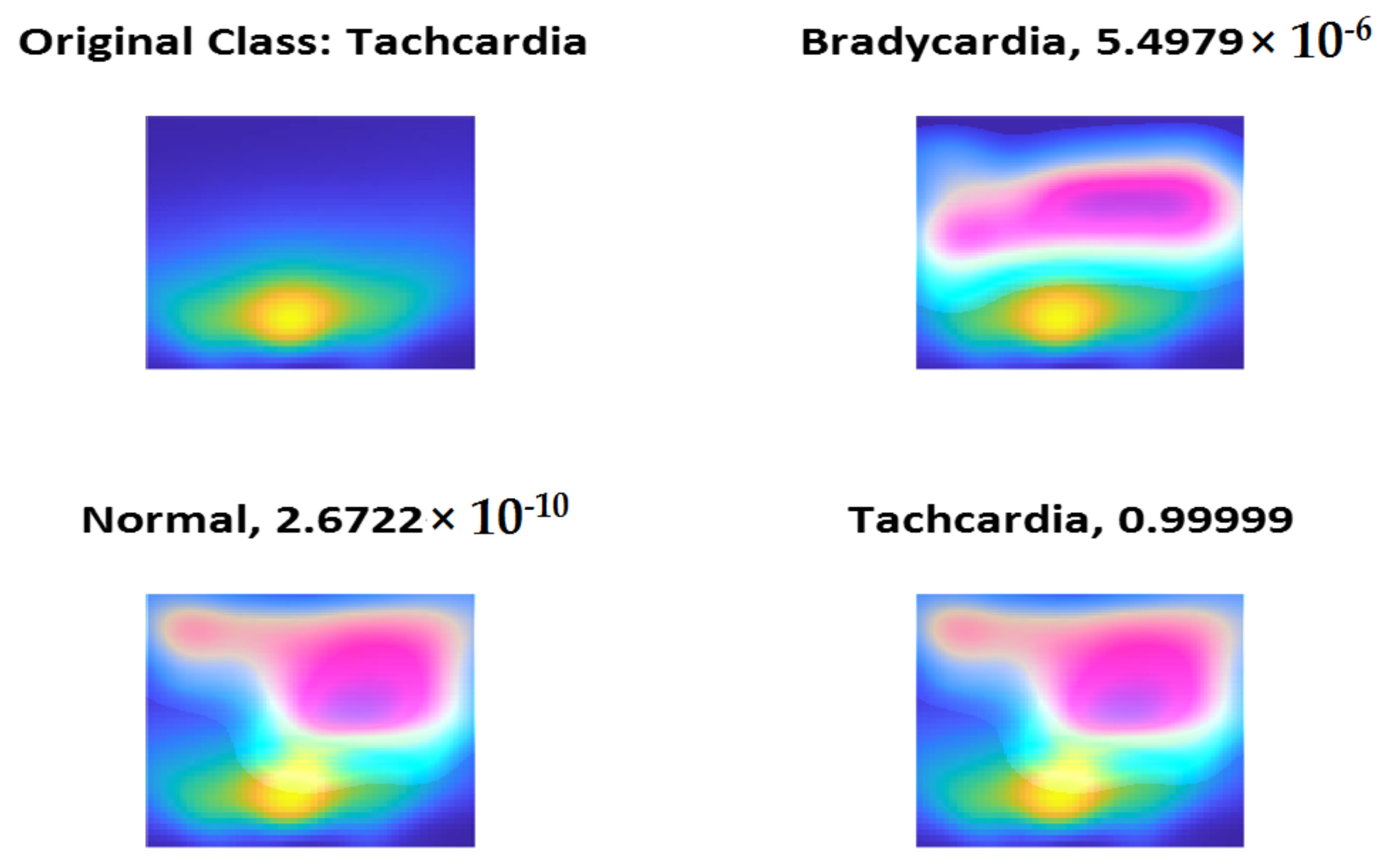 Diagnostics 13 00308 g016 Diagnostics 13 00308 g016