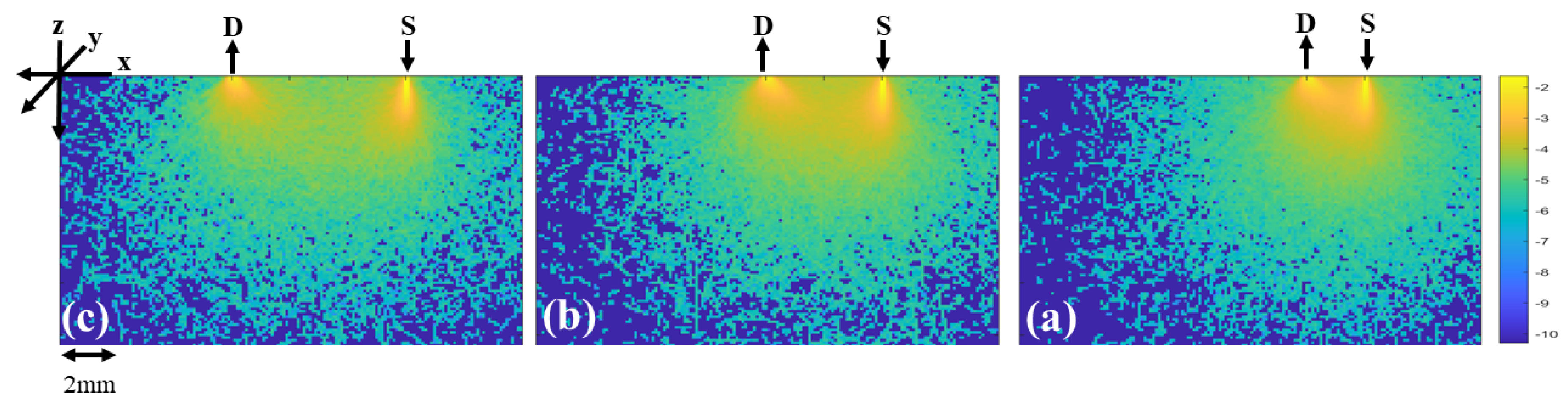Diagnostics 13 00309 g004