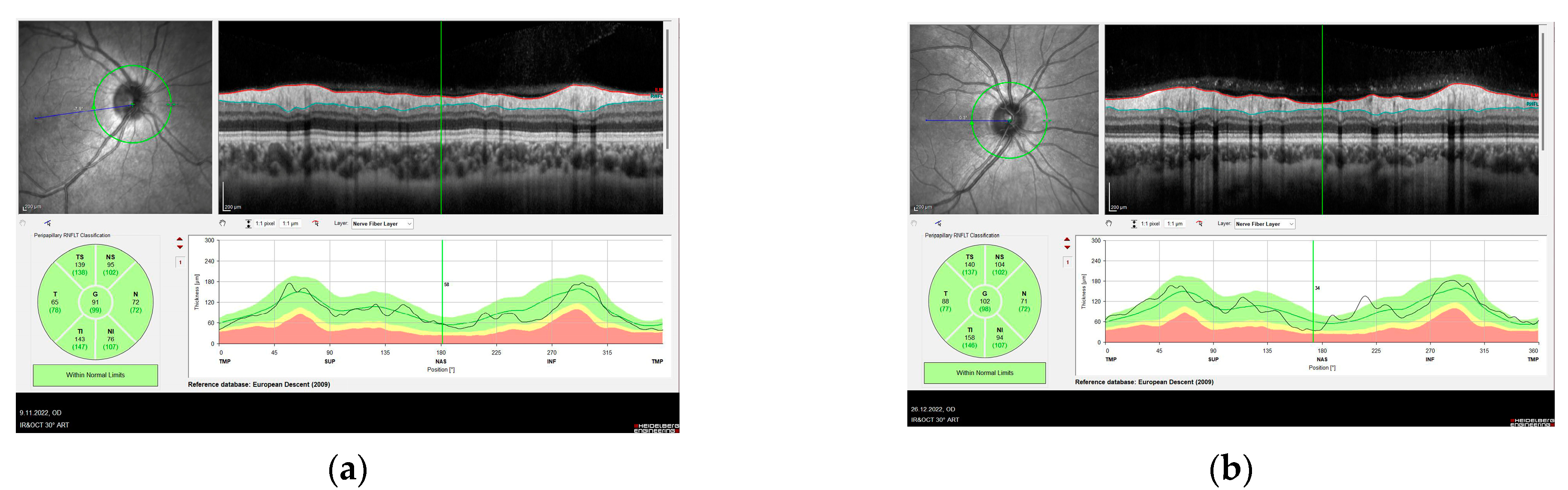 Diagnostics 13 00314 g002 Diagnostics 13 00314 g002