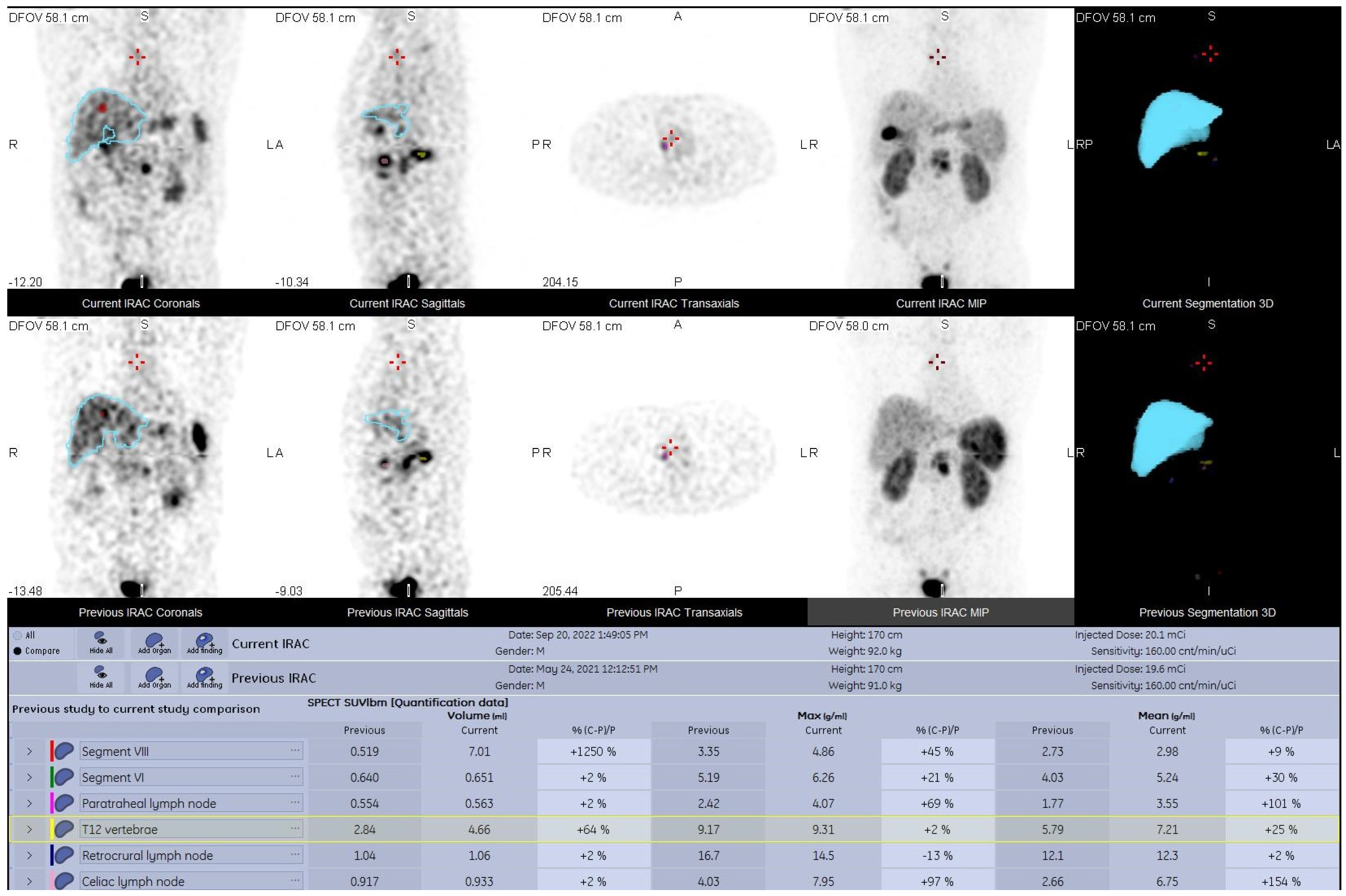 Diagnostics 13 00318 g003 Diagnostics 13 00318 g003